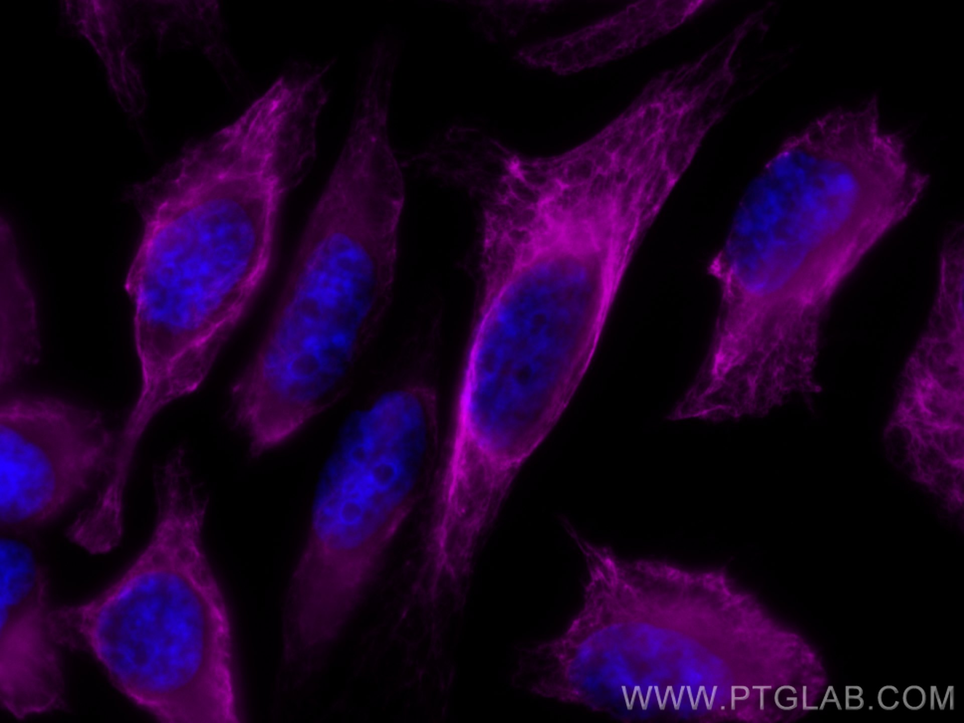 Cytokeratin 17-Specific