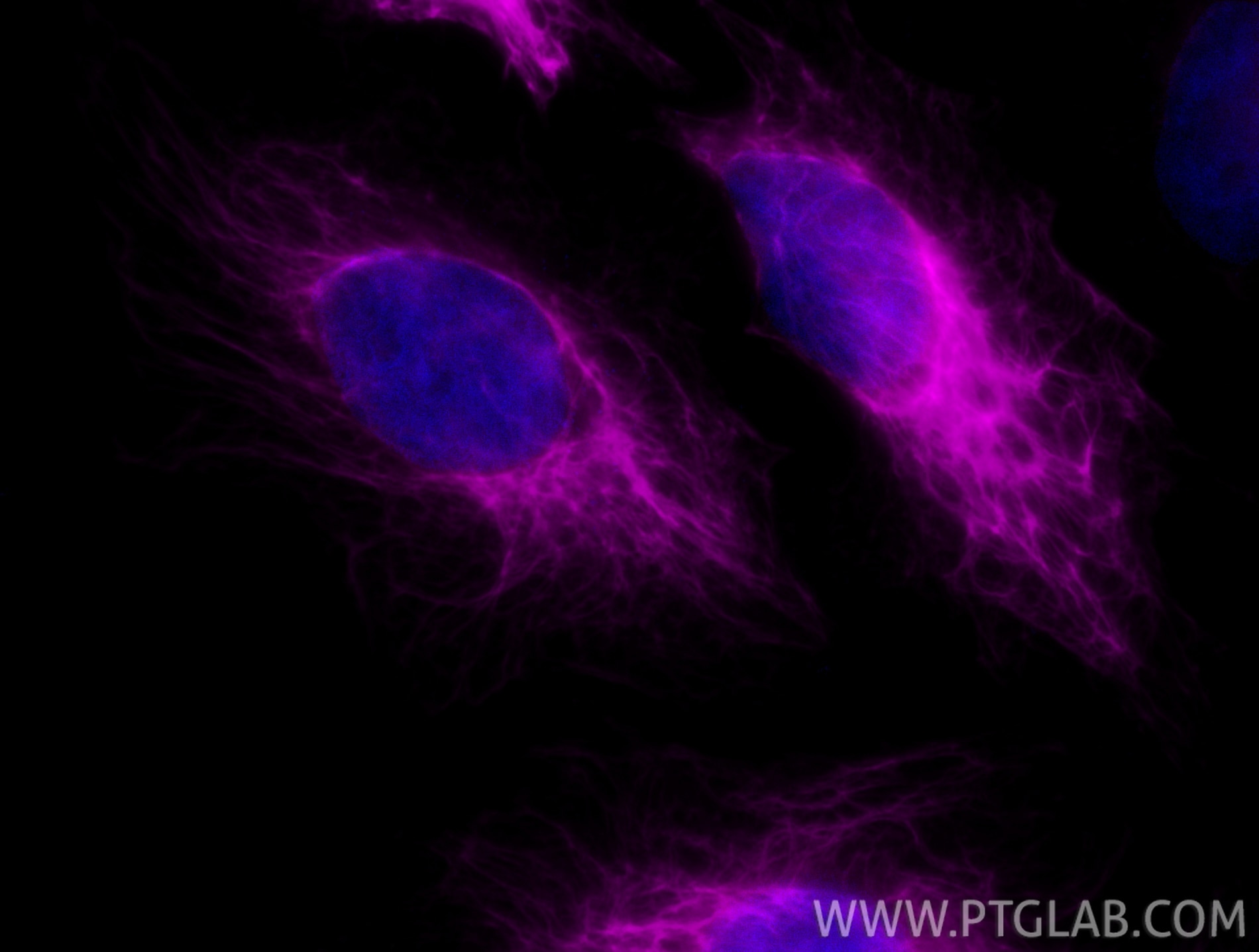 Immunofluorescence (IF) / fluorescent staining of HeLa cells using CoraLite® Plus 647-conjugated Cytokeratin 17-Speci (CL647-17516)