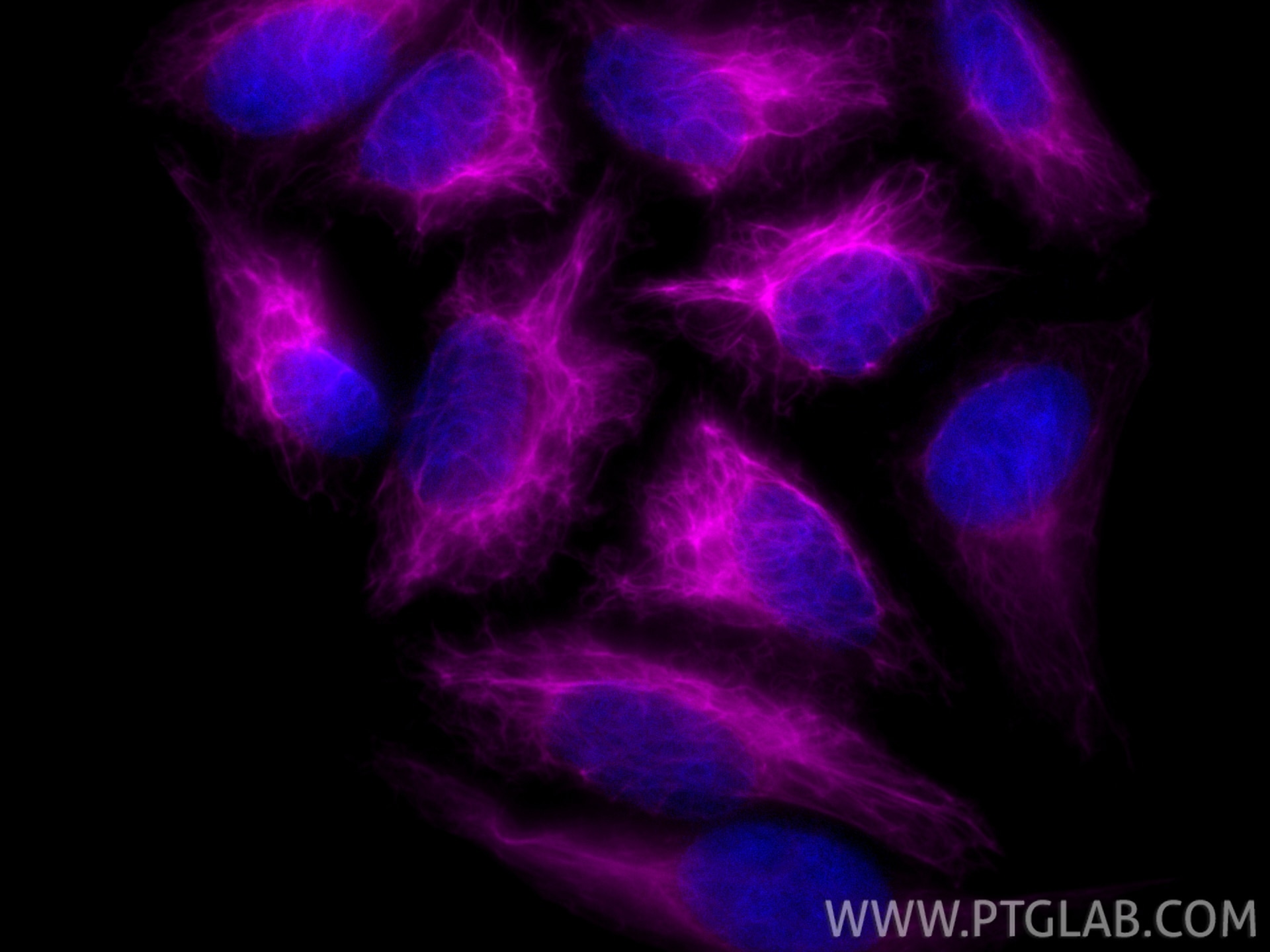 Immunofluorescence (IF) / fluorescent staining of HepG2 cells using CoraLite® Plus 647-conjugated Cytokeratin 17-Speci (CL647-17516)
