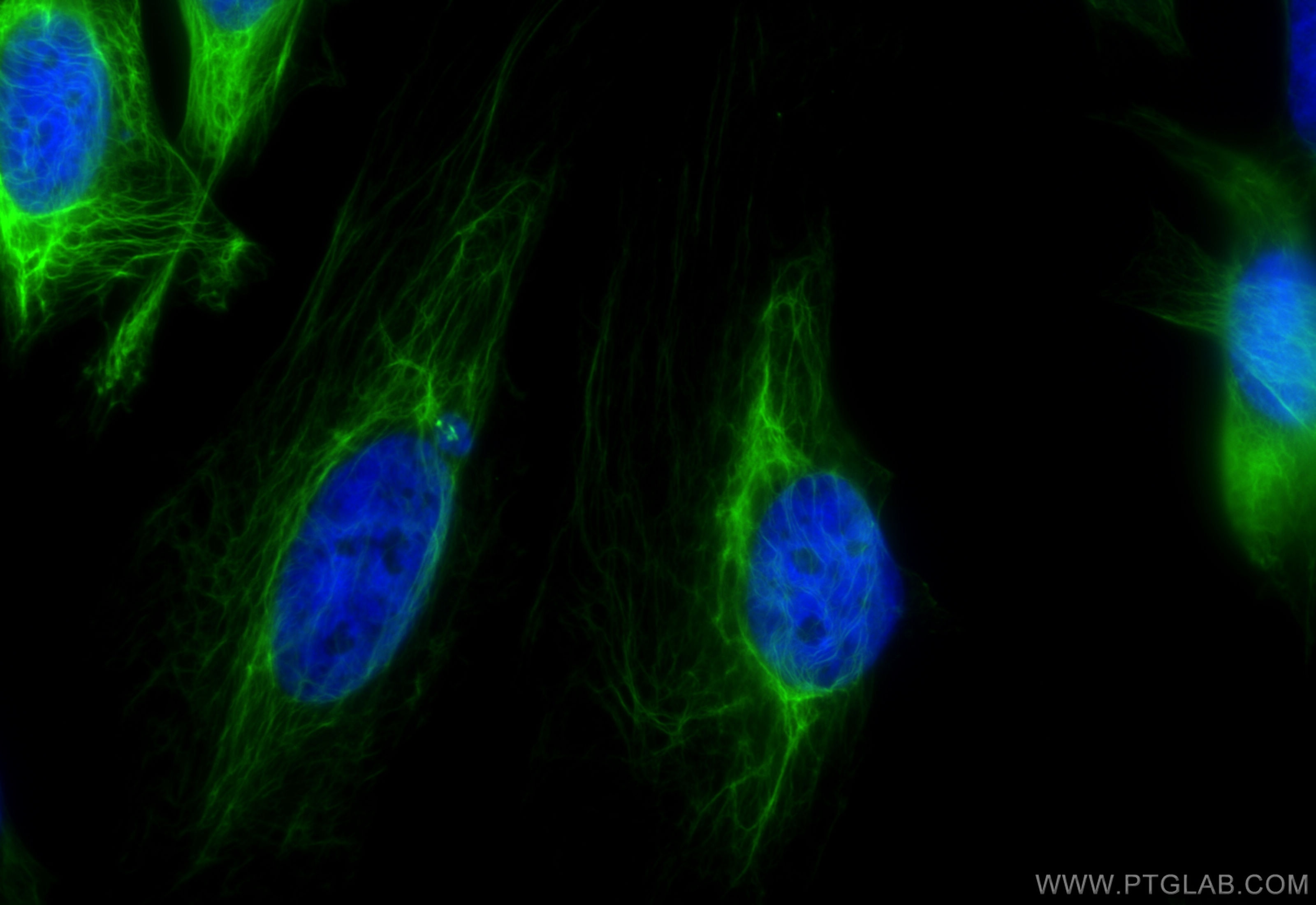 Immunofluorescence (IF) / fluorescent staining of HeLa cells using CoraLite® Plus 488-conjugated Cytokeratin 17-speci (CL488-84978)