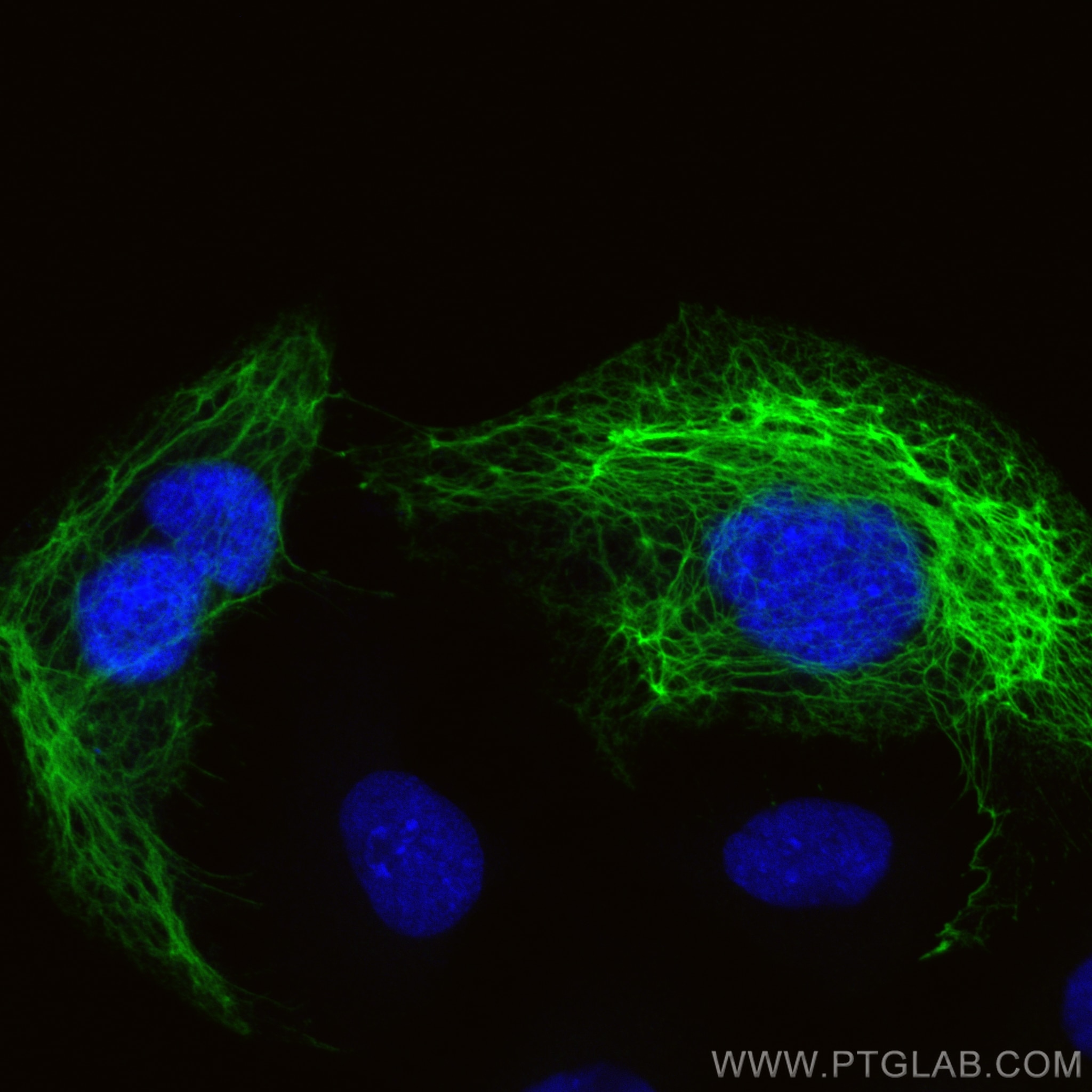 Immunofluorescence (IF) / fluorescent staining of HaCaT cells using CoraLite® Plus 488-conjugated Cytokeratin 17-speci (CL488-84978)