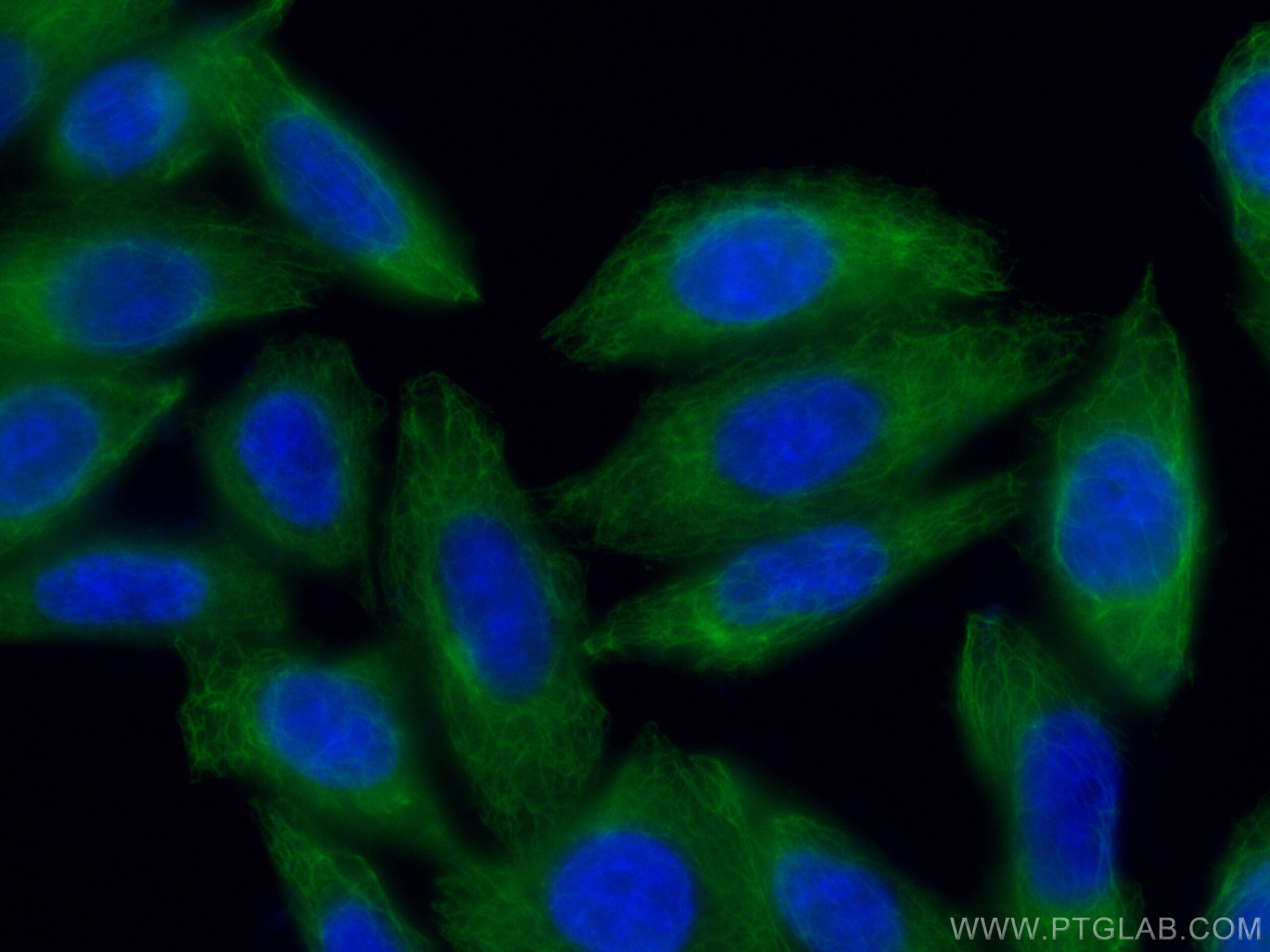 Immunofluorescence (IF) / fluorescent staining of HepG2 cells using CoraLite® Plus 488-conjugated Cytokeratin 18 Polyc (CL488-10830)