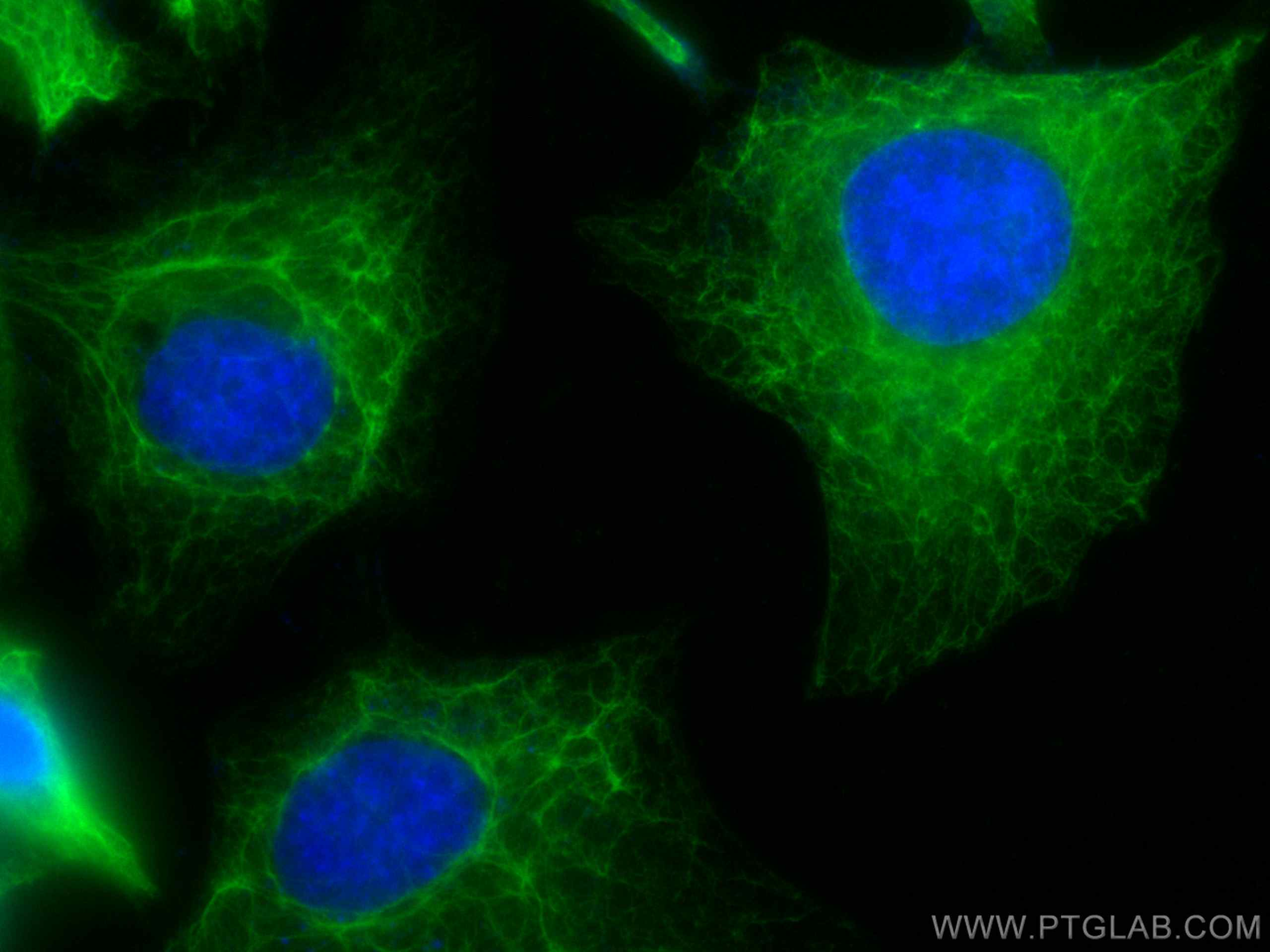 Cytokeratin 18