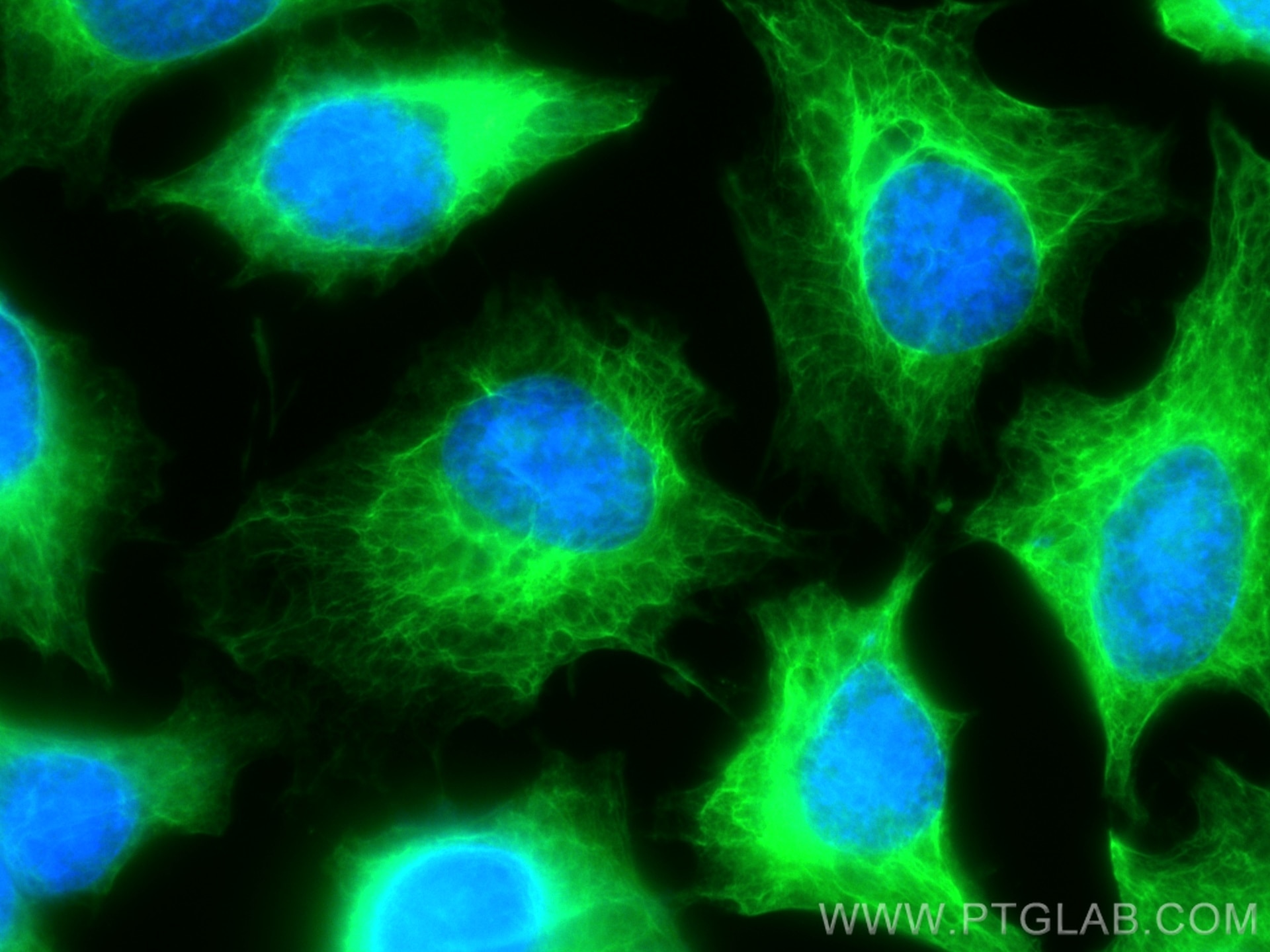 Immunofluorescence (IF) / fluorescent staining of HeLa cells using CoraLite® Plus 488-conjugated Cytokeratin 18 Polyc (CL488-10830)
