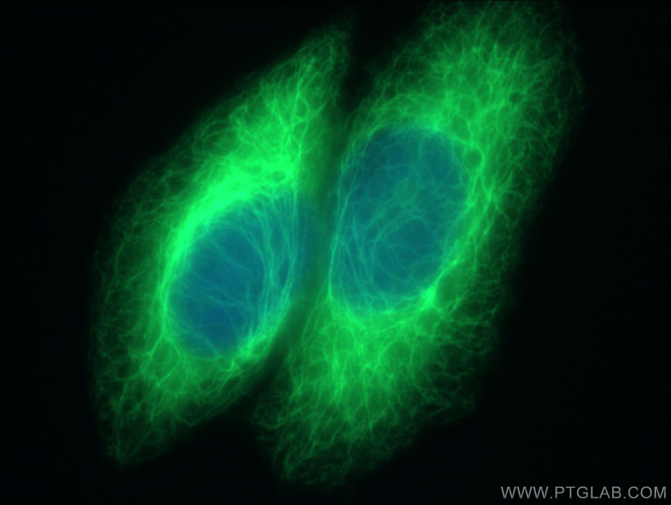 Cytokeratin 18