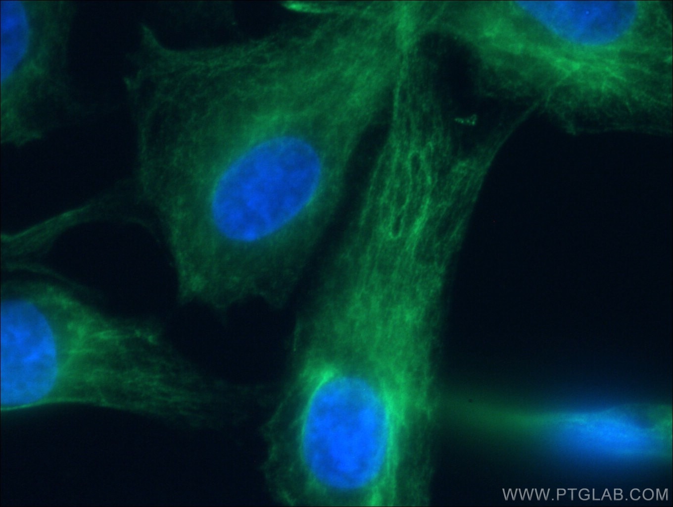 Immunofluorescence (IF) / fluorescent staining of MDCK cells using CoraLite® Plus 488-conjugated Cytokeratin 18 Monoc (CL488-66187)