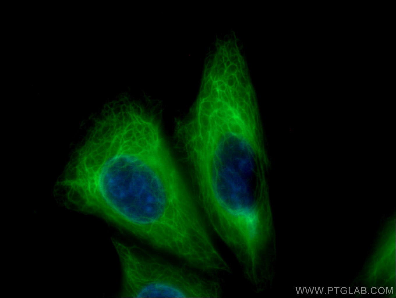 Immunofluorescence (IF) / fluorescent staining of HepG2 cells using CoraLite® Plus 488-conjugated Cytokeratin 18 Monoc (CL488-66187)
