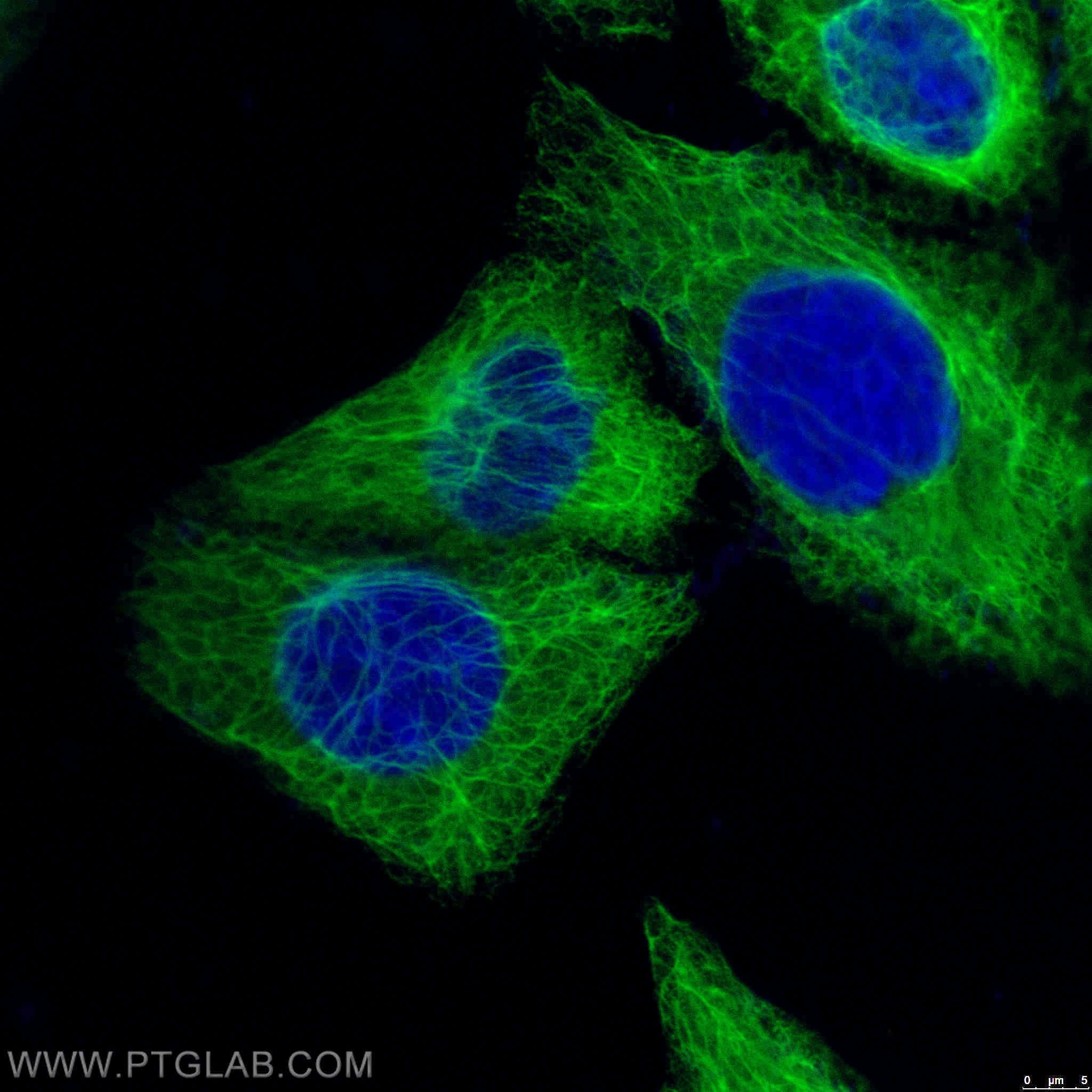 Immunofluorescence (IF) / fluorescent staining of HeLa cells using CoraLite® Plus 488-conjugated Cytokeratin 18 Monoc (CL488-66187)