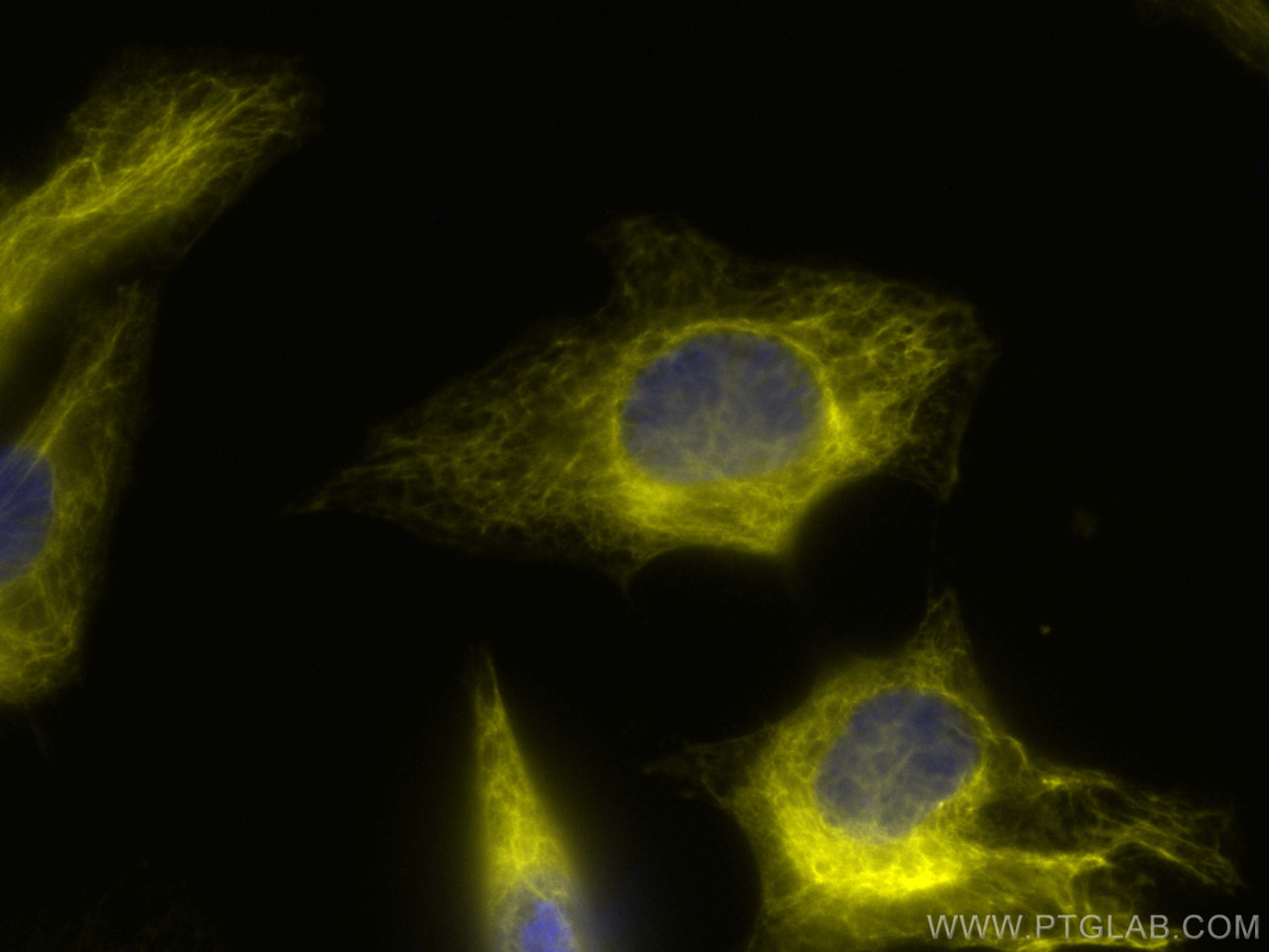 Immunofluorescence (IF) / fluorescent staining of HeLa cells using CoraLite® Plus 532-conjugated Cytokeratin 18 Monoc (CL532-66187)