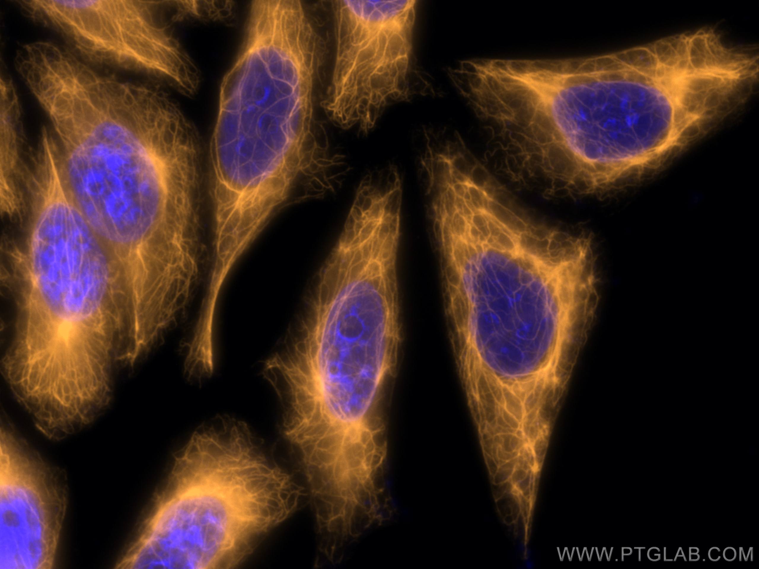 Immunofluorescence (IF) / fluorescent staining of HepG2 cells using CoraLite®555-conjugated Cytokeratin 18 Monoclonal  (CL555-66187)