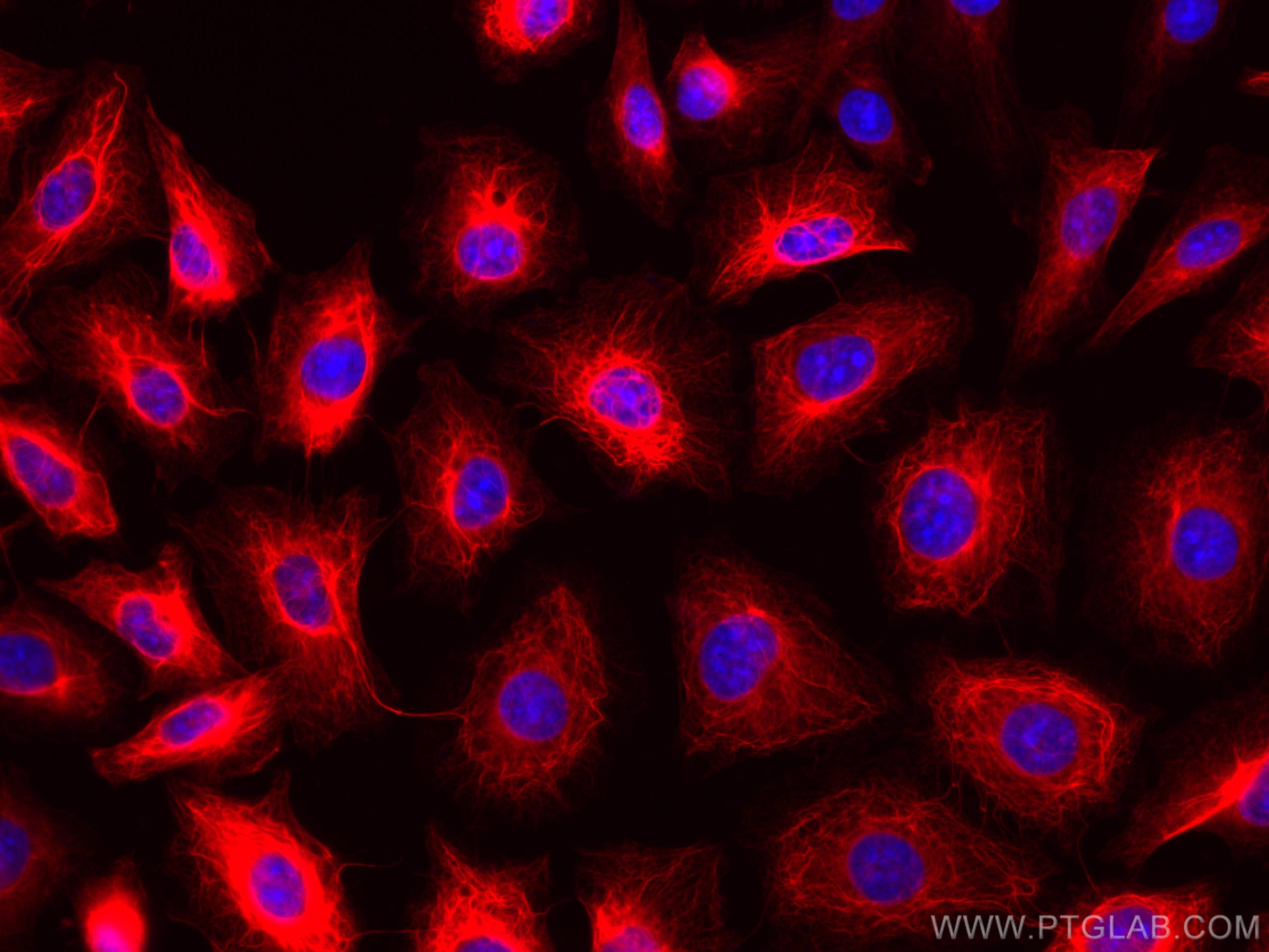 Immunofluorescence (IF) / fluorescent staining of HUVEC cells using CoraLite®568-conjugated Cytokeratin 18 Monoclonal  (CL568-66187)