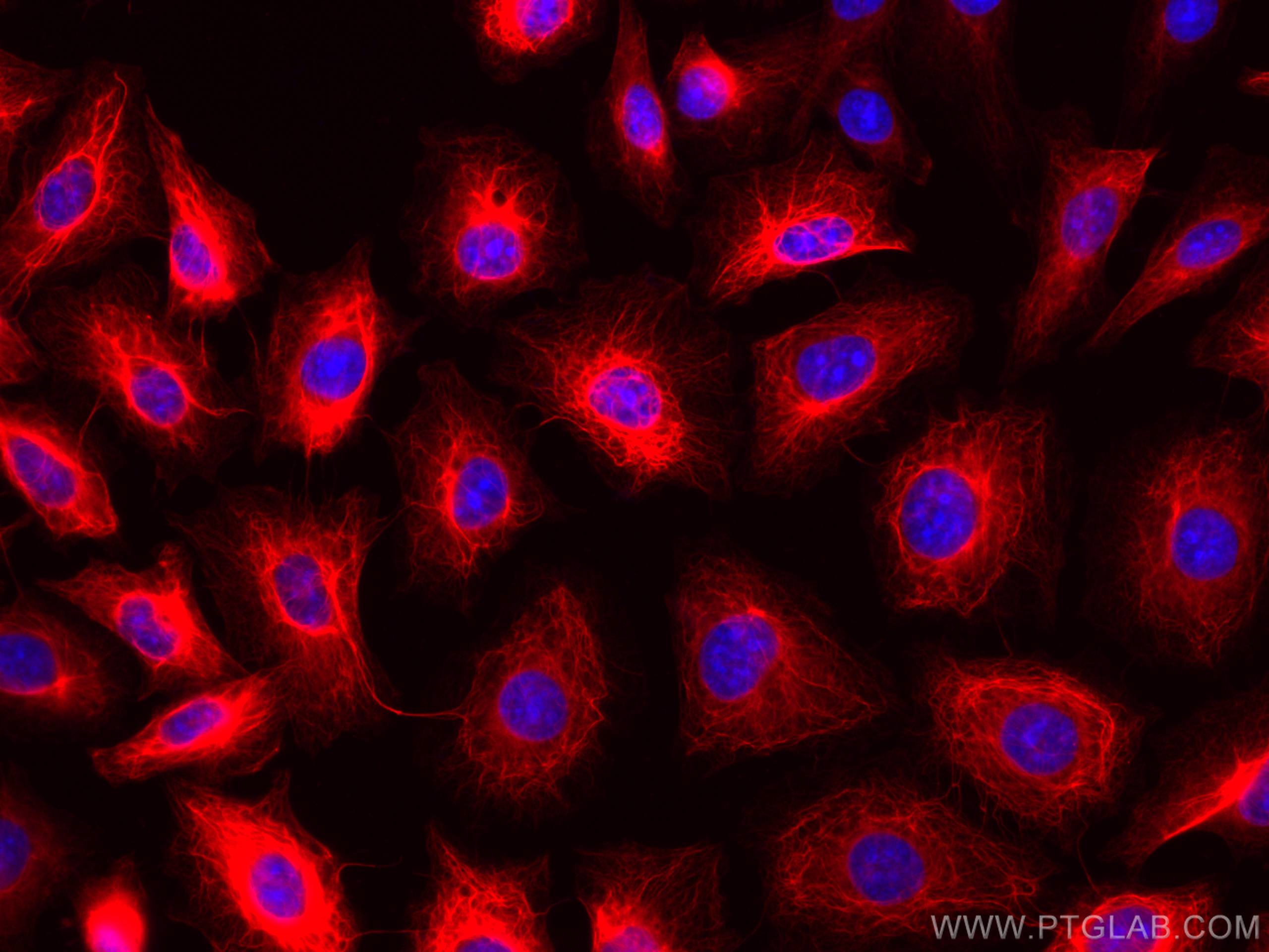 IF Staining of HUVEC using CL568-66187