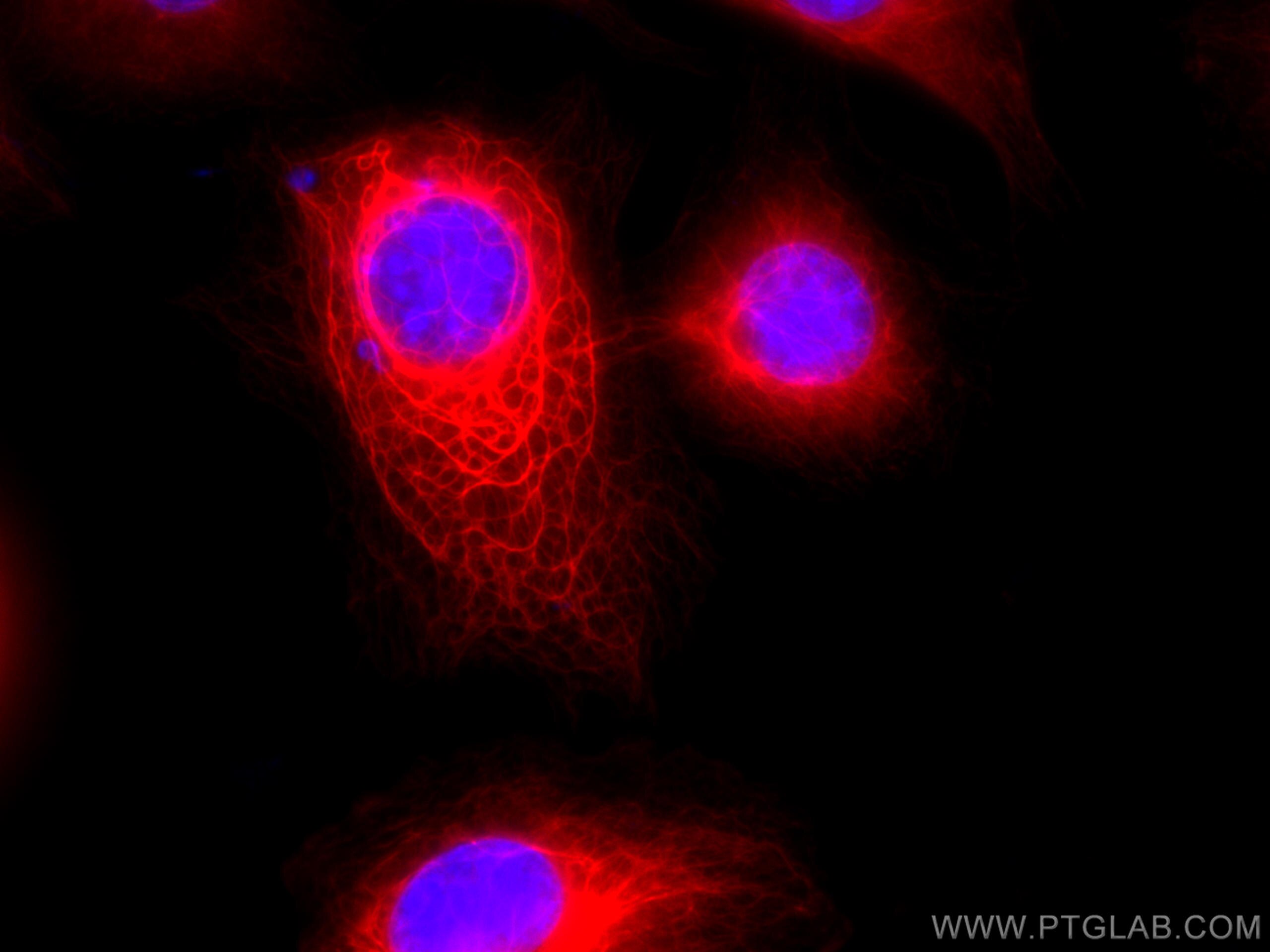 Immunofluorescence (IF) / fluorescent staining of HUVEC cells using CoraLite®568-conjugated Cytokeratin 18 Monoclonal  (CL568-66187)