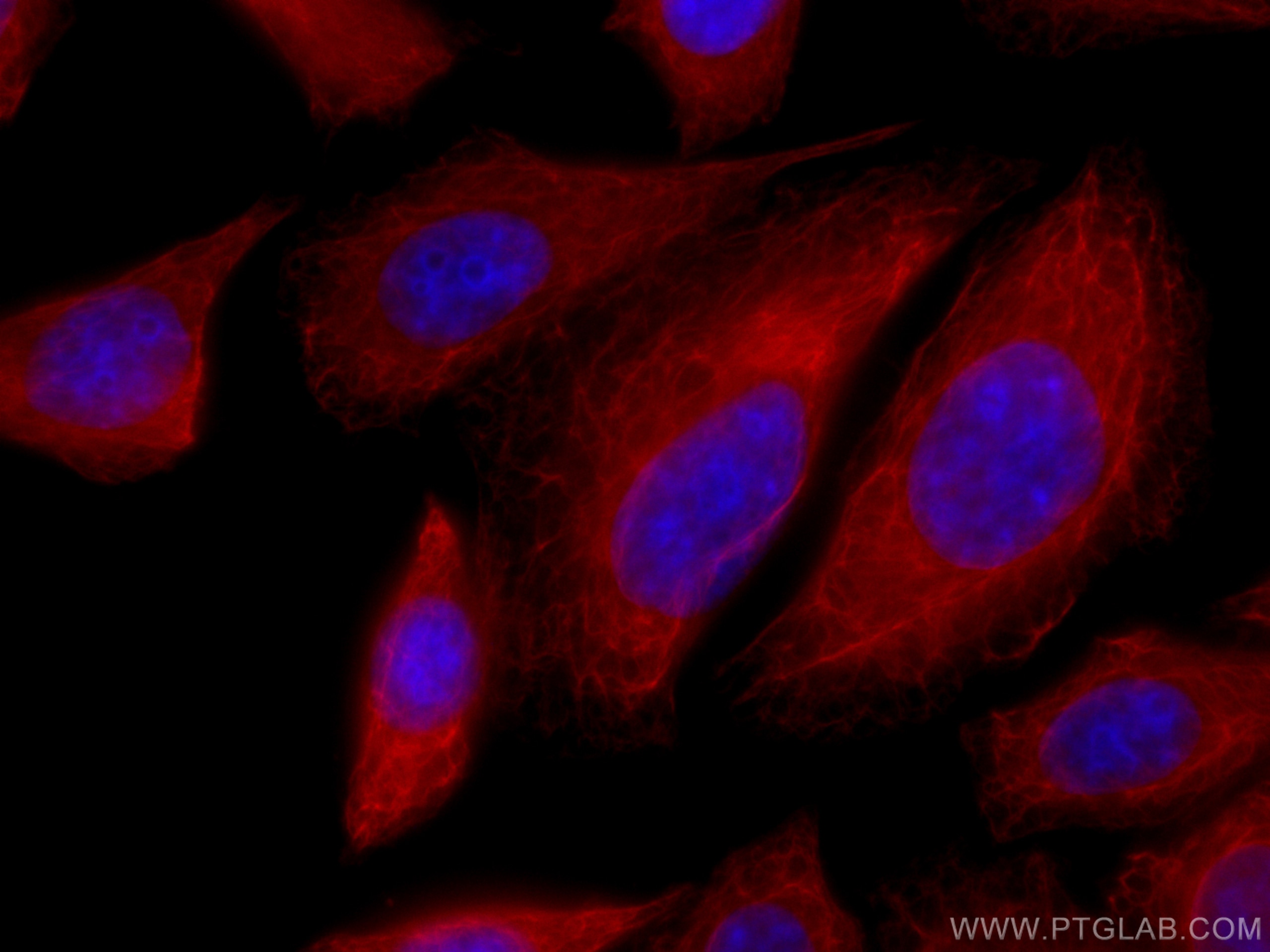 Immunofluorescence (IF) / fluorescent staining of HepG2 cells using CoraLite®594-conjugated Cytokeratin 18 Polyclonal  (CL594-10830)