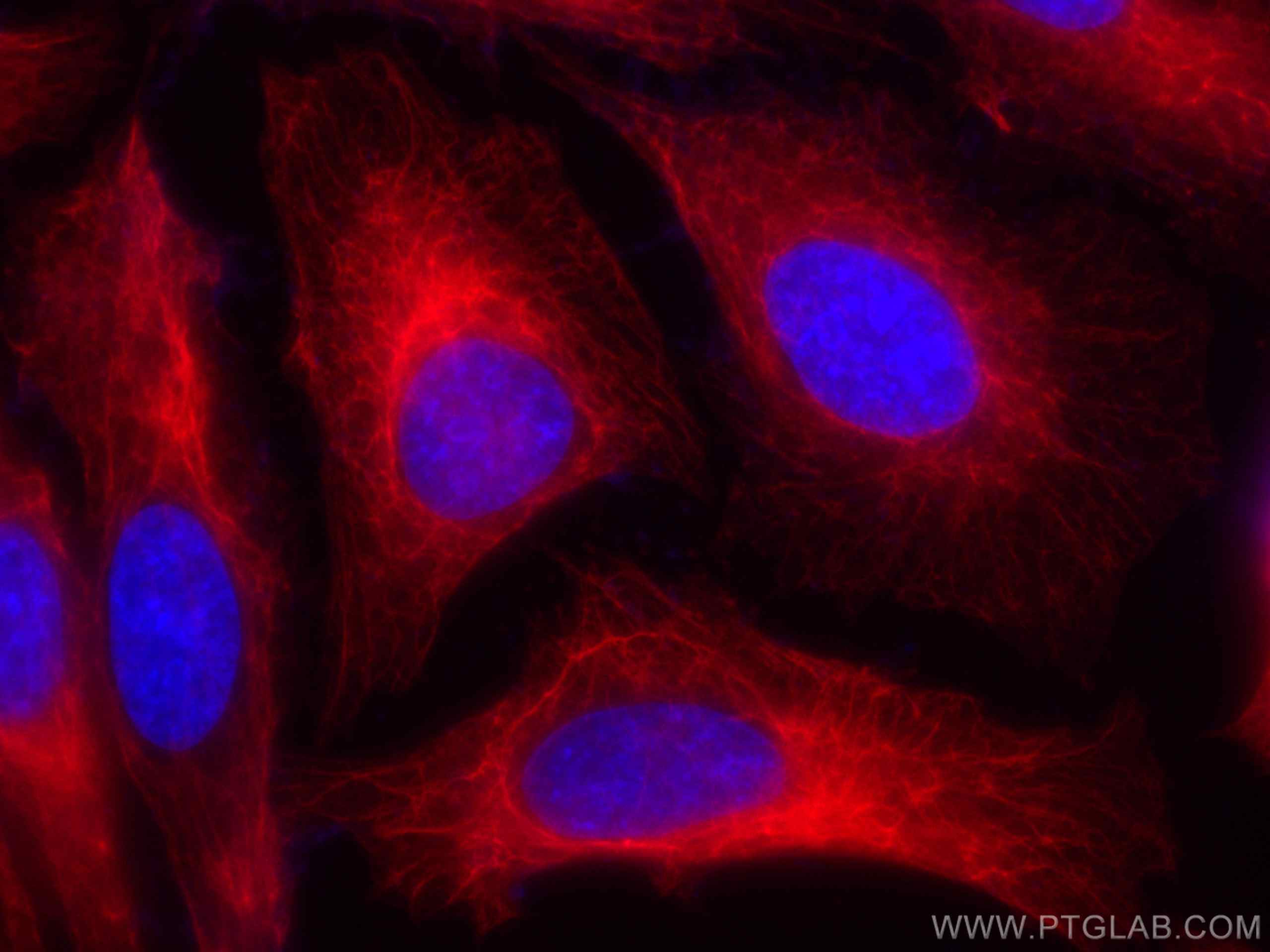 Immunofluorescence (IF) / fluorescent staining of HeLa cells using CoraLite®594-conjugated Cytokeratin 18 Polyclonal  (CL594-10830)