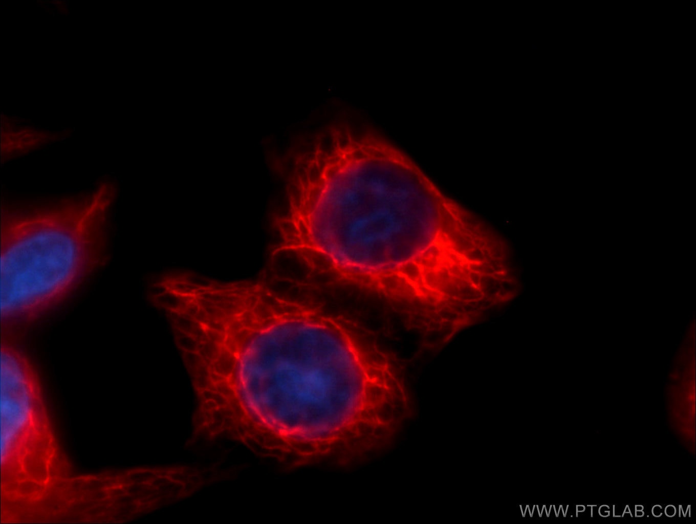 Immunofluorescence (IF) / fluorescent staining of HepG2 cells using CoraLite®594-conjugated KRT18 Monoclonal antibody (CL594-66187)