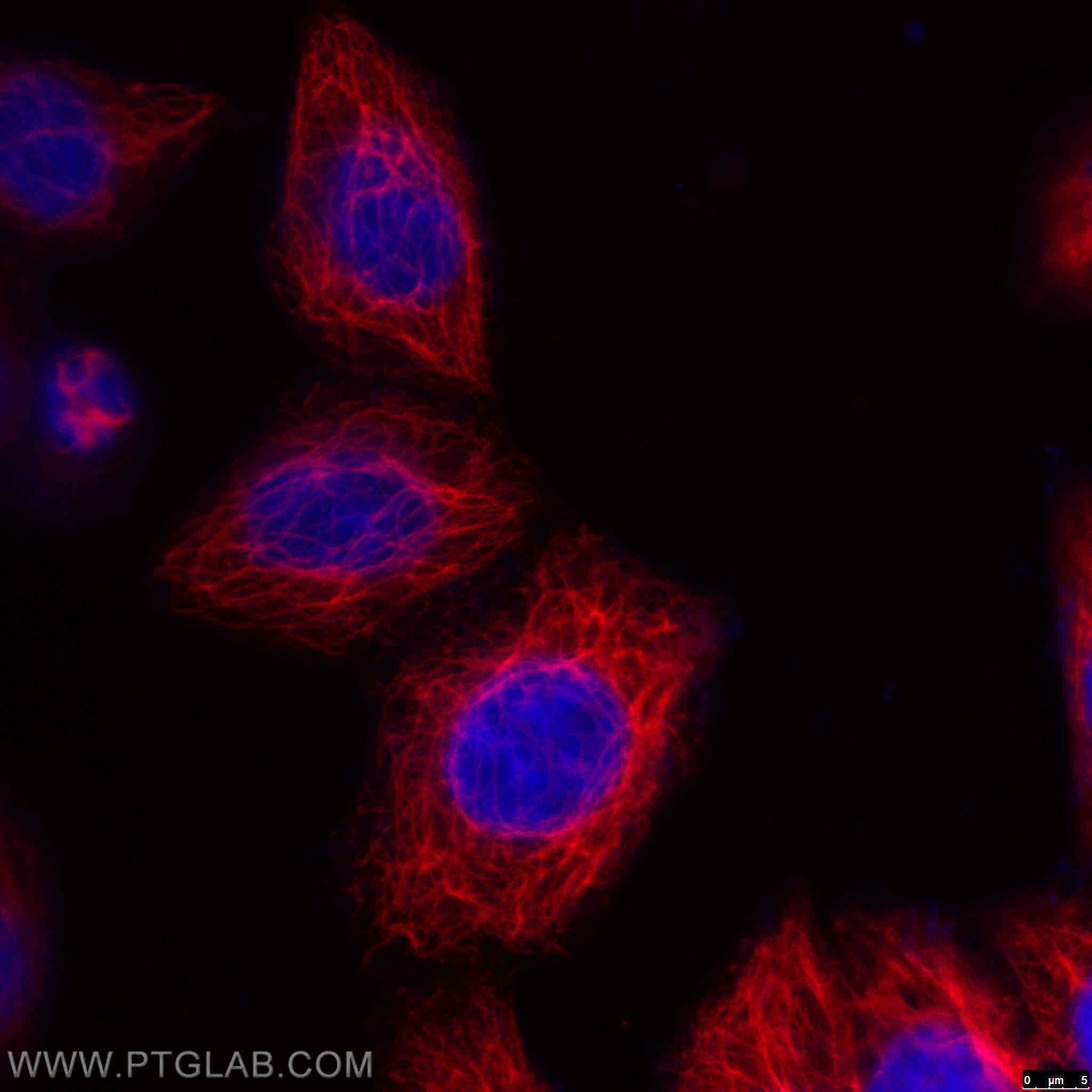 Immunofluorescence (IF) / fluorescent staining of HeLa cells using CoraLite®594-conjugated KRT18 Monoclonal antibody (CL594-66187)