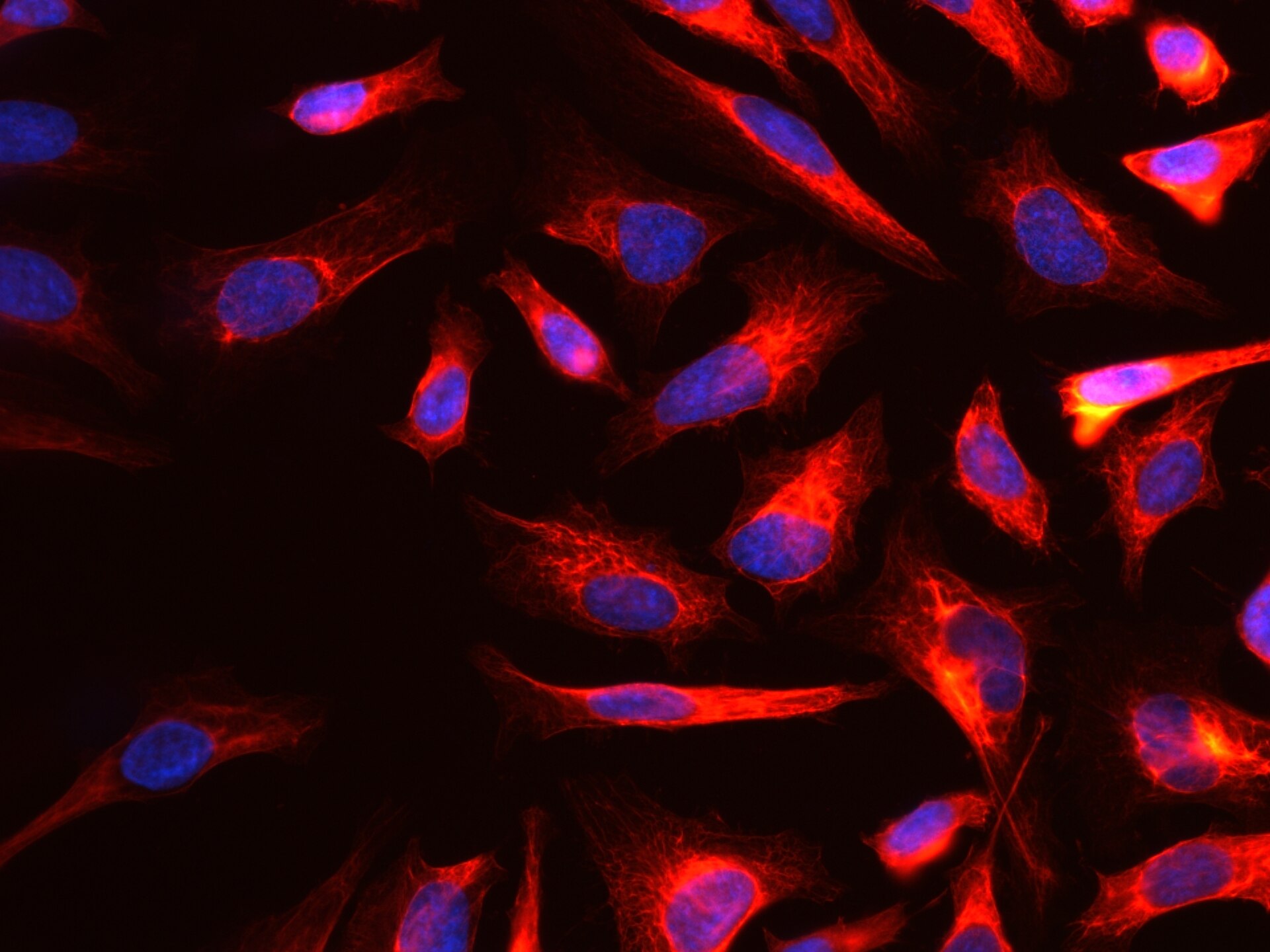 Cytokeratin 18