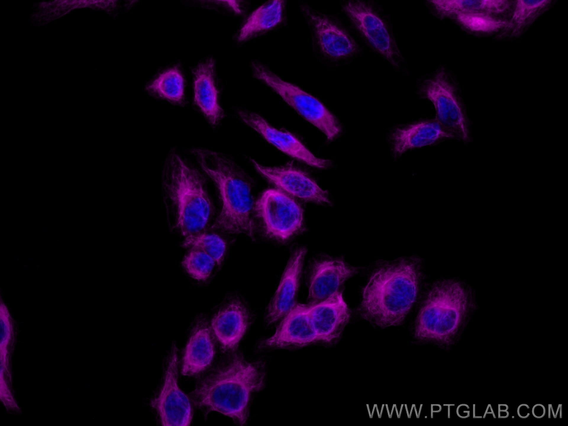 Immunofluorescence (IF) / fluorescent staining of HepG2 cells using CoraLite® Plus 647-conjugated Cytokeratin 18 Monoc (CL647-66187)