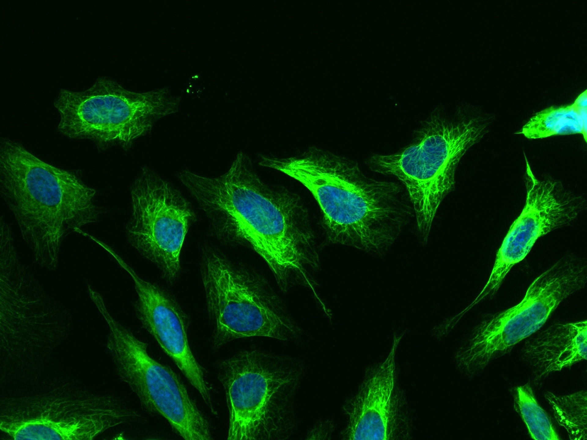 Immunofluorescence (IF) / fluorescent staining of HeLa cells using FITC-conjugated Cytokeratin 18 Monoclonal antibody (FITC-66187)
