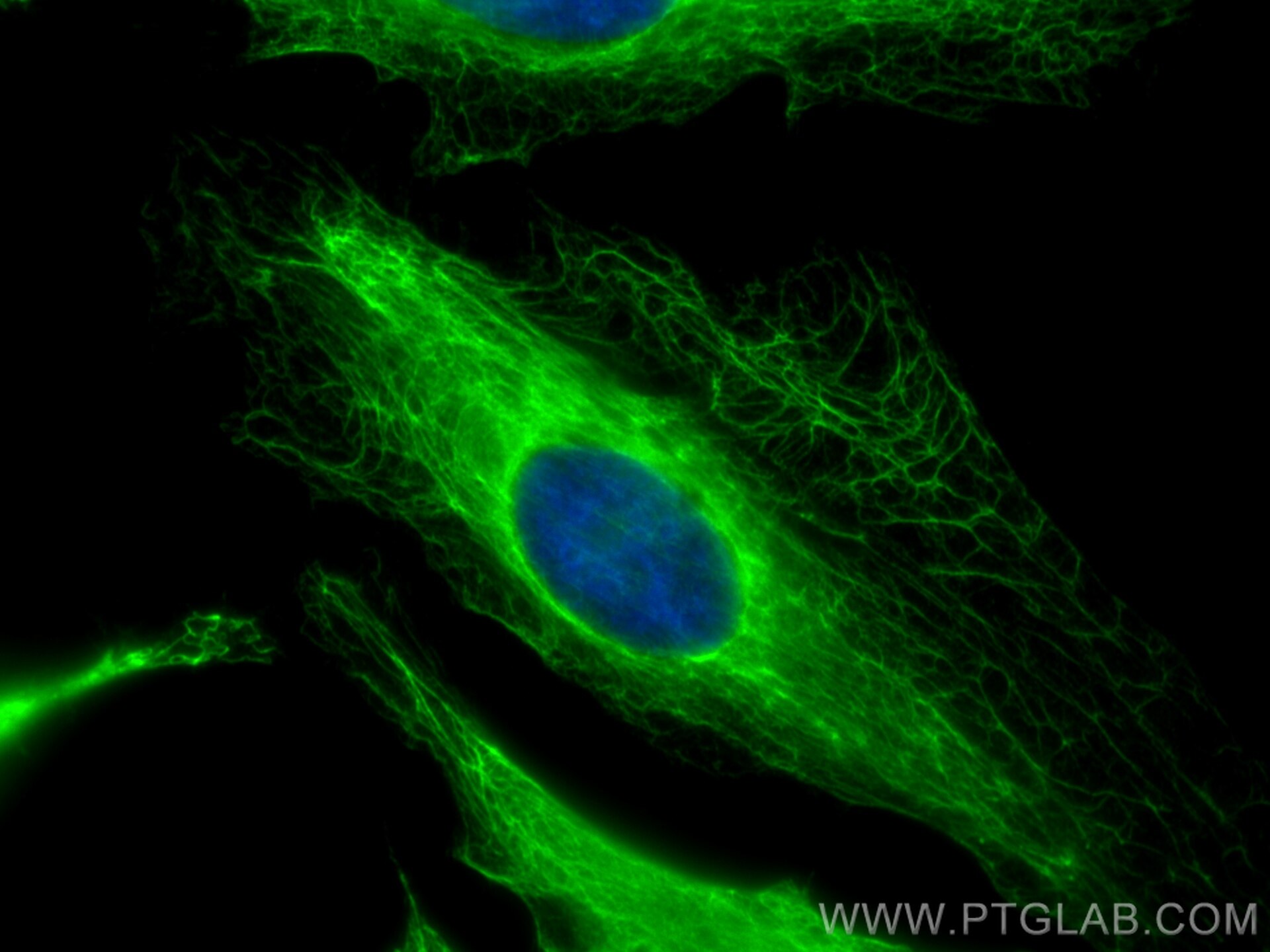 Immunofluorescence (IF) / fluorescent staining of HeLa cells using Cytokeratin 19 Polyclonal antibody (29855-1-AP)