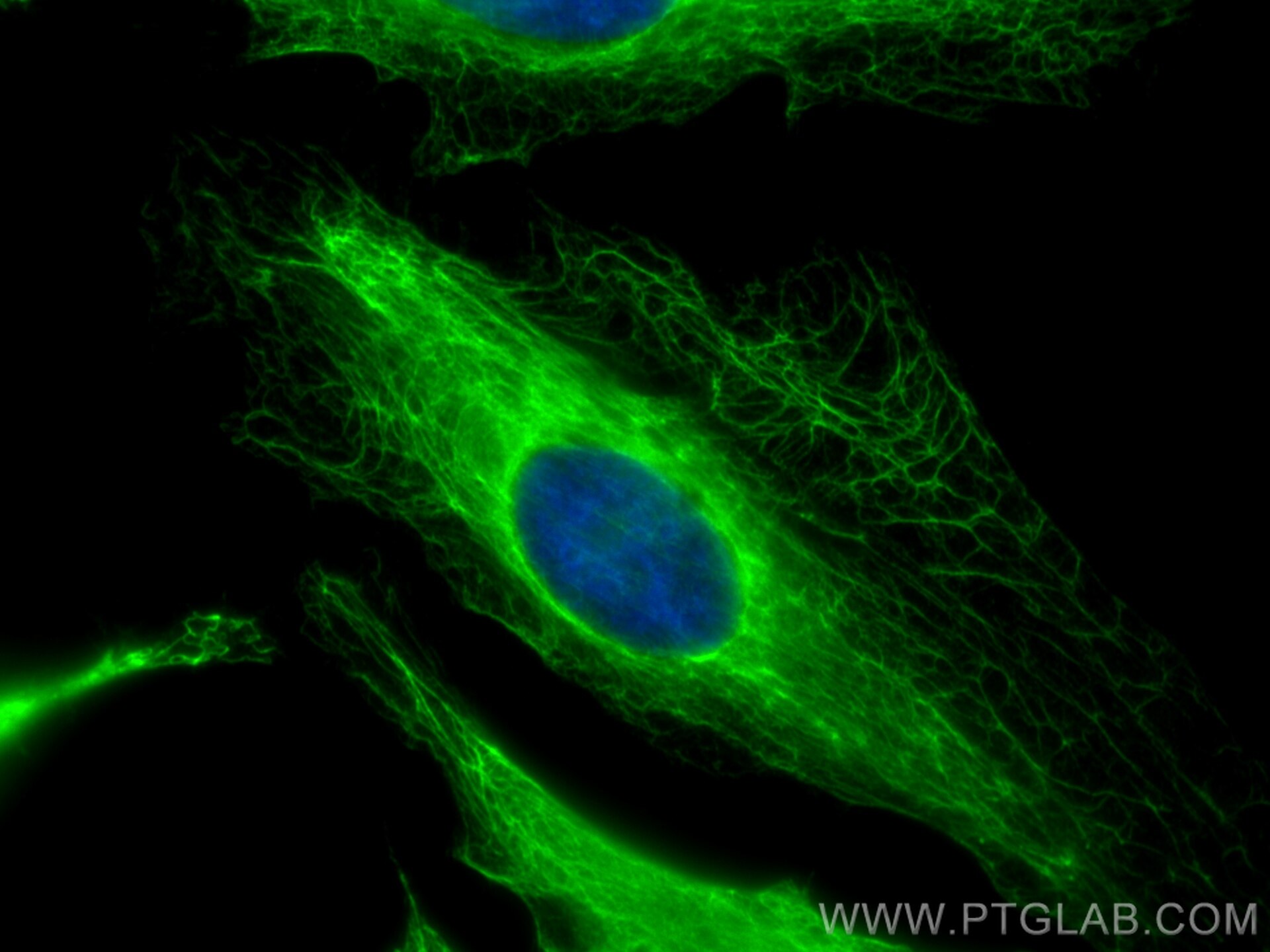 IF Staining of HeLa using 29855-1-AP