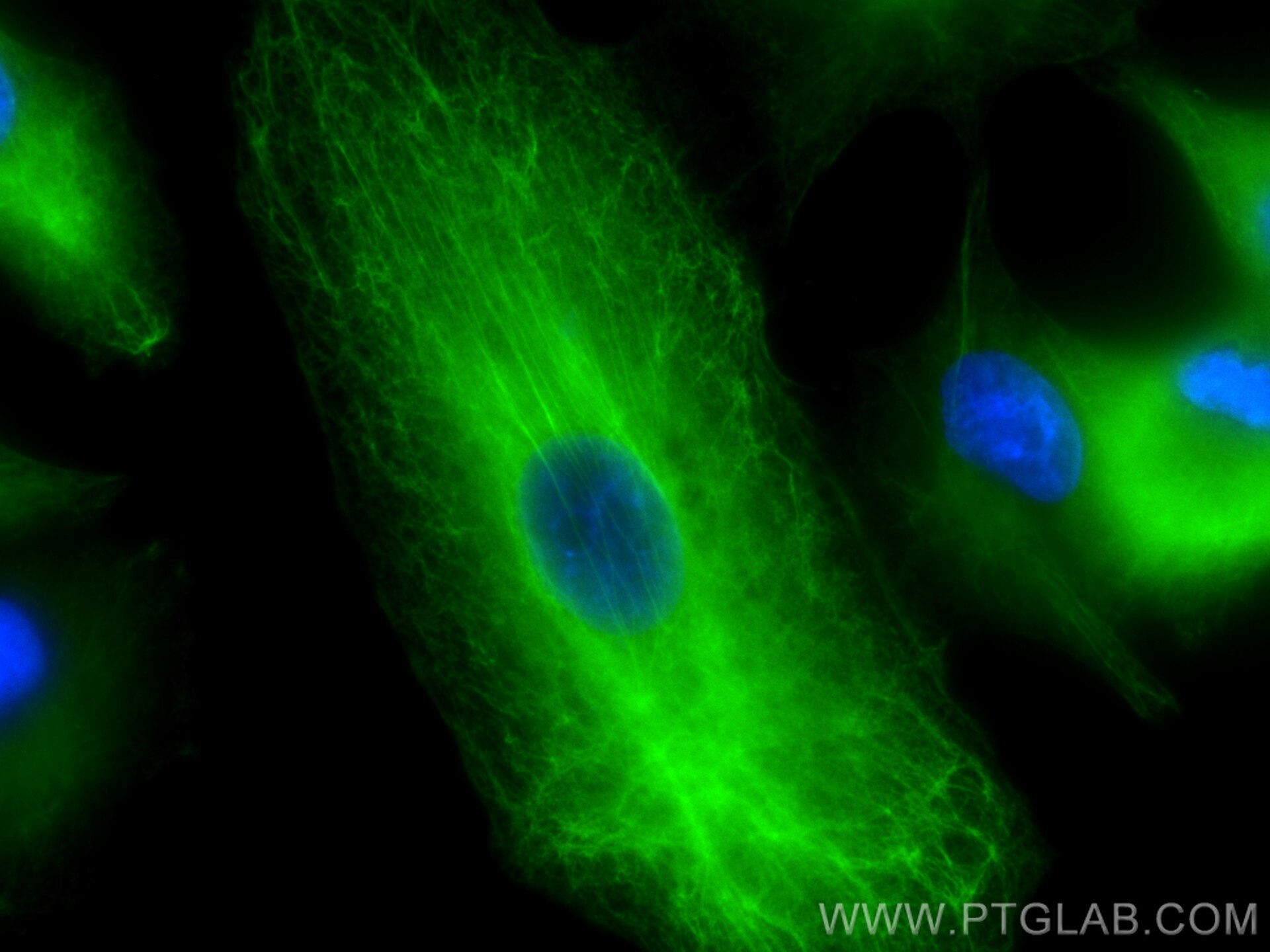 Immunofluorescence (IF) / fluorescent staining of A549 cells using Cytokeratin 19 Polyclonal antibody (29855-1-AP)