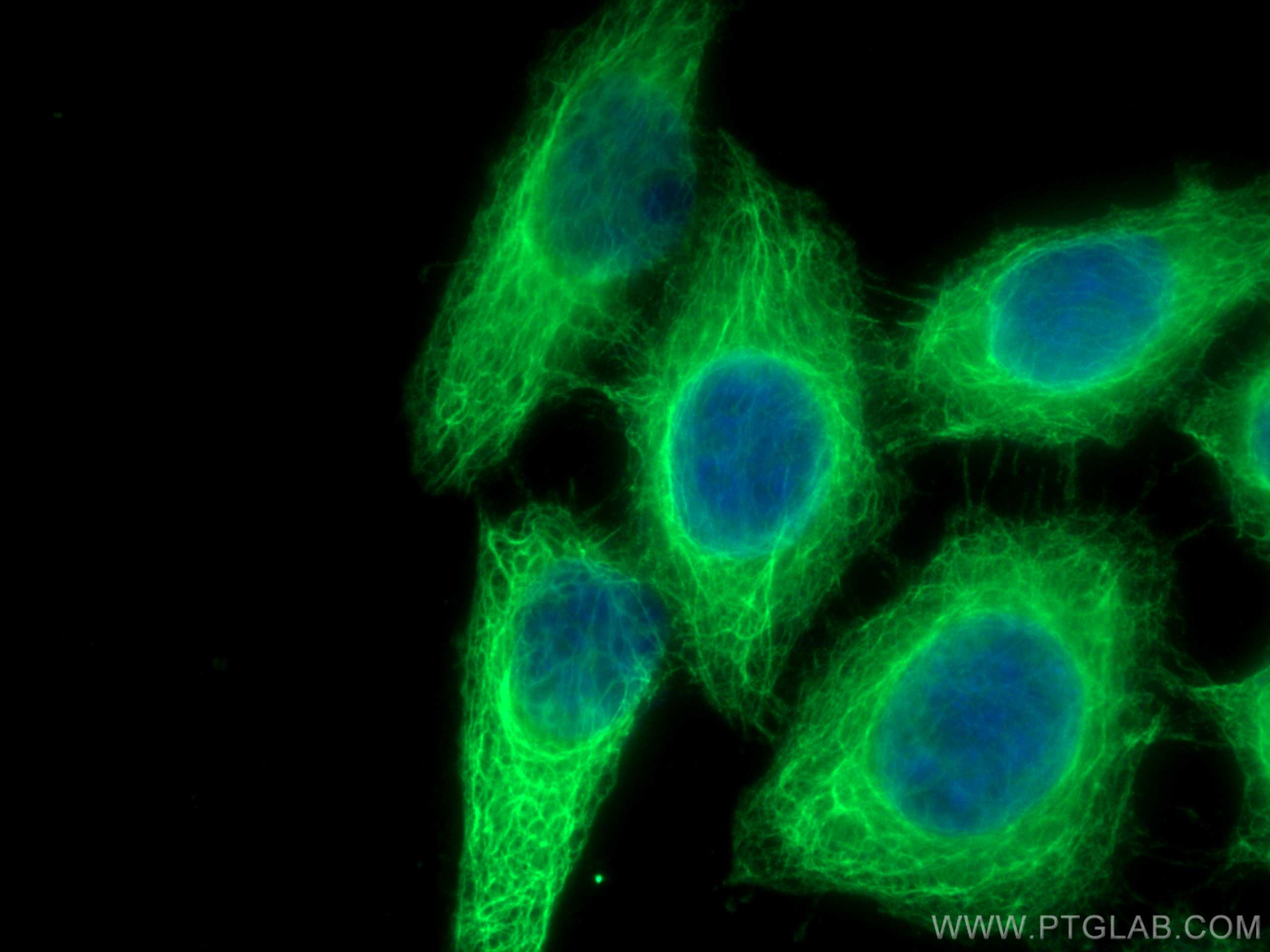 Immunofluorescence (IF) / fluorescent staining of HepG2 cells using Cytokeratin 19 Polyclonal antibody (29855-1-AP)