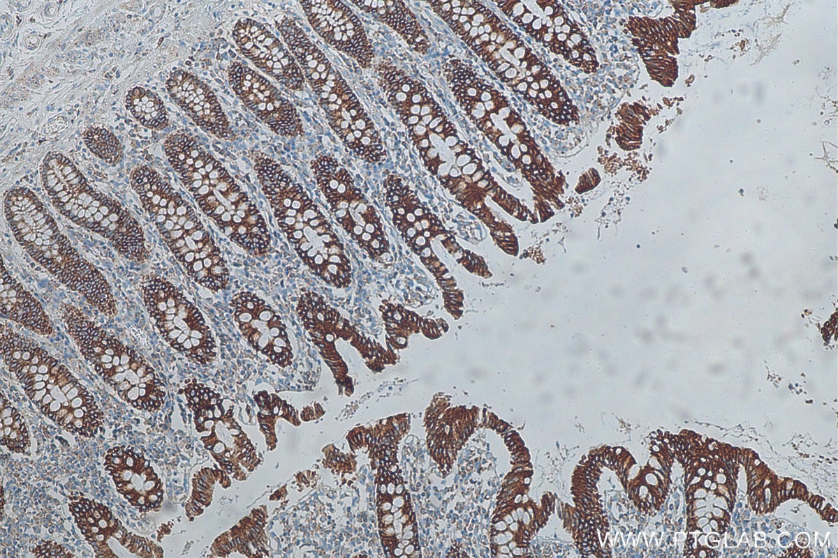 Immunohistochemistry (IHC) staining of human colon tissue using Cytokeratin 19 Polyclonal antibody (29855-1-AP)