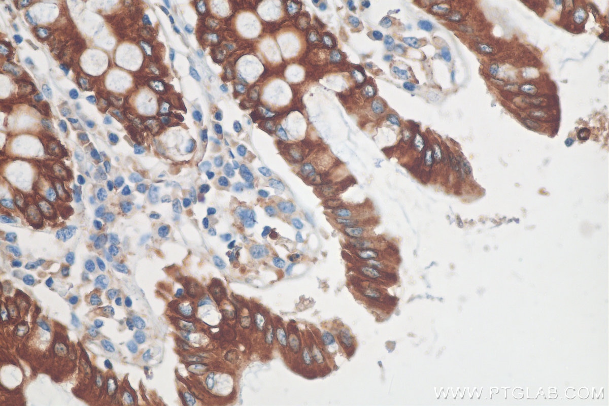 IHC staining of human colon using 29855-1-AP