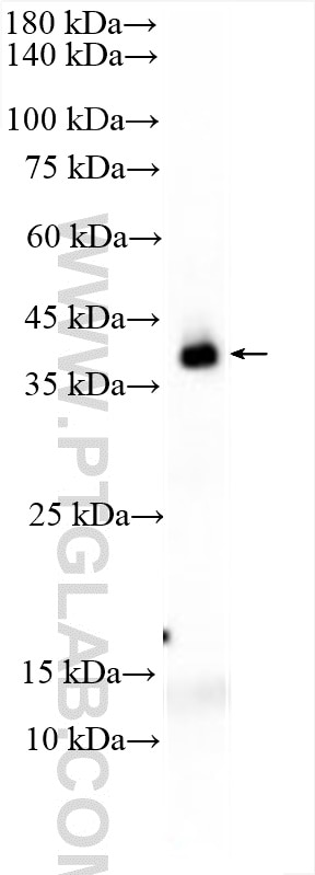 WB analysis of BxPC-3 using 29855-1-AP