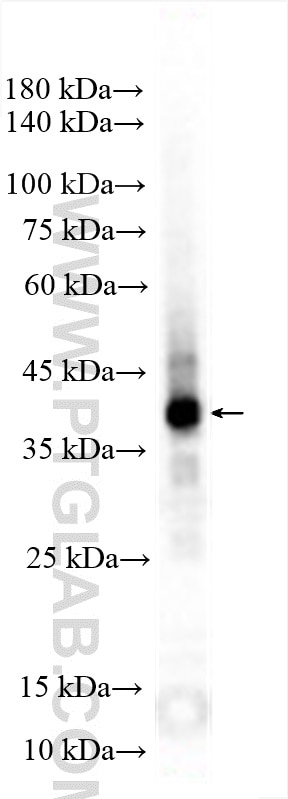 Cytokeratin 19