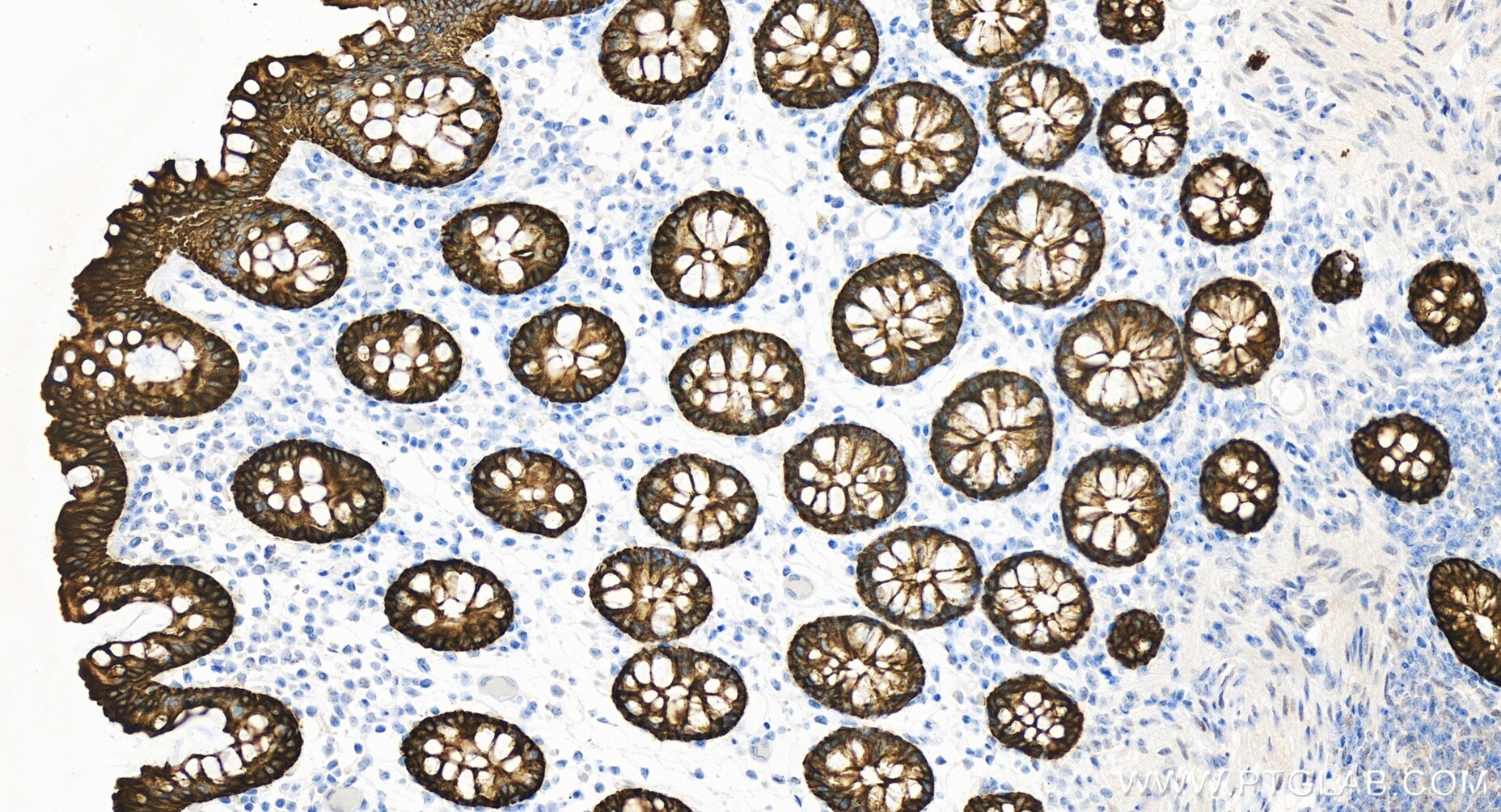 Immunohistochemistry (IHC) staining of human colon tissue using Cytokeratin 19 Recombinant antibody (86250-1-RR)