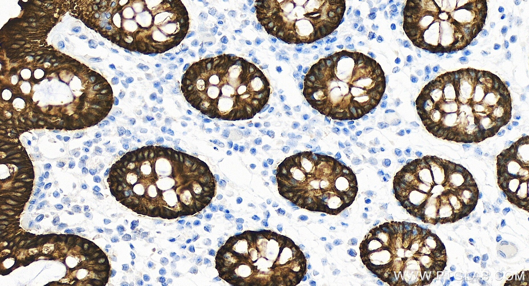 Immunohistochemistry (IHC) staining of human colon tissue using Cytokeratin 19 Recombinant antibody (86250-1-RR)