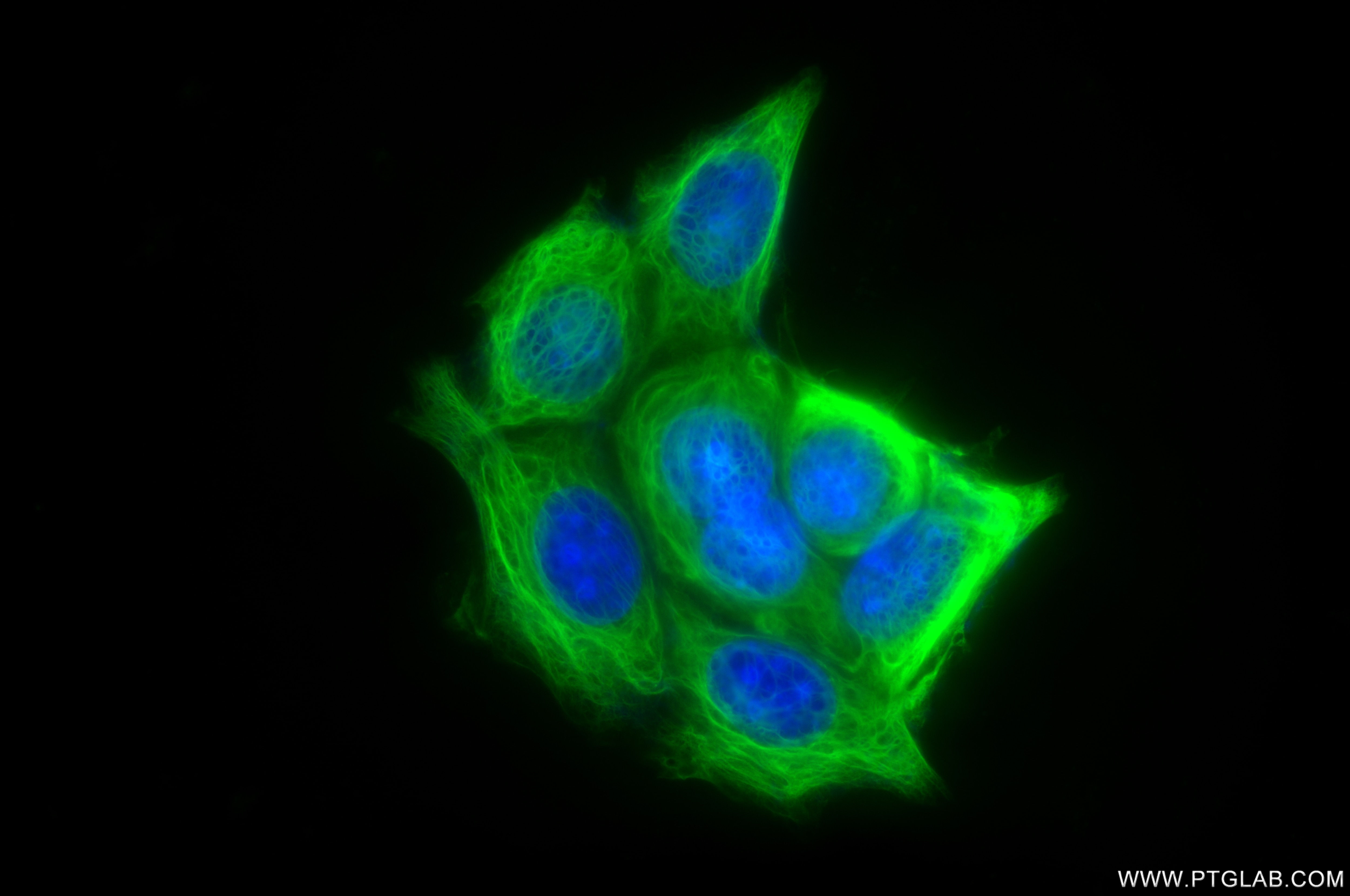 Immunofluorescence (IF) / fluorescent staining of MCF-7 cells using Cytokeratin 19 Recombinant antibody (86250-1-RR)