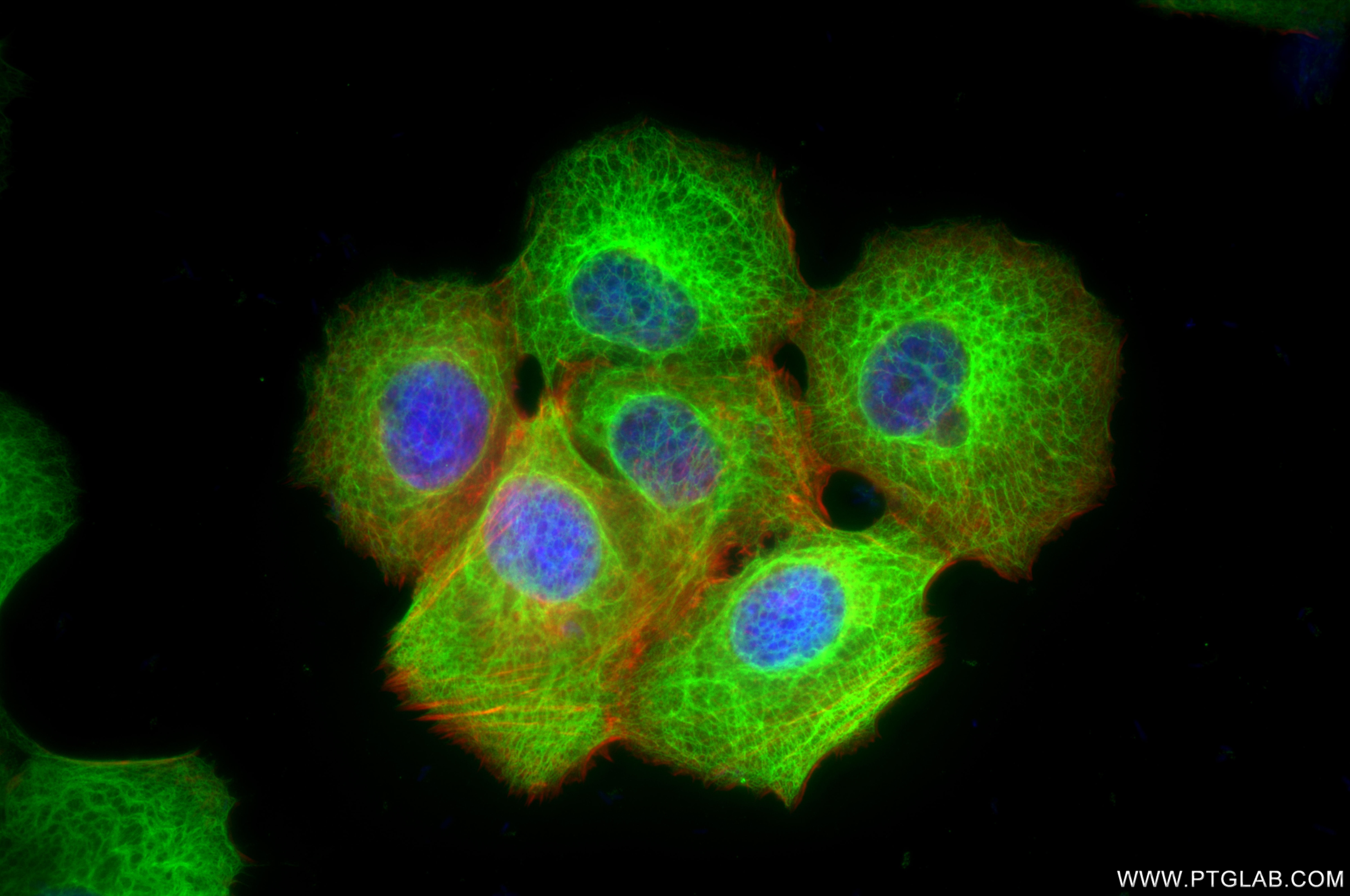 Immunofluorescence (IF) / fluorescent staining of MCF-7 cells using Cytokeratin 19 Recombinant monoclonal antibody (86250-1-RR)