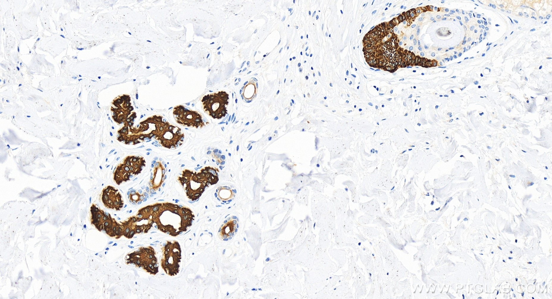 Immunohistochemistry (IHC) staining of human skin tissue using Cytokeratin 19 Recombinant antibody (86250-1-RR)