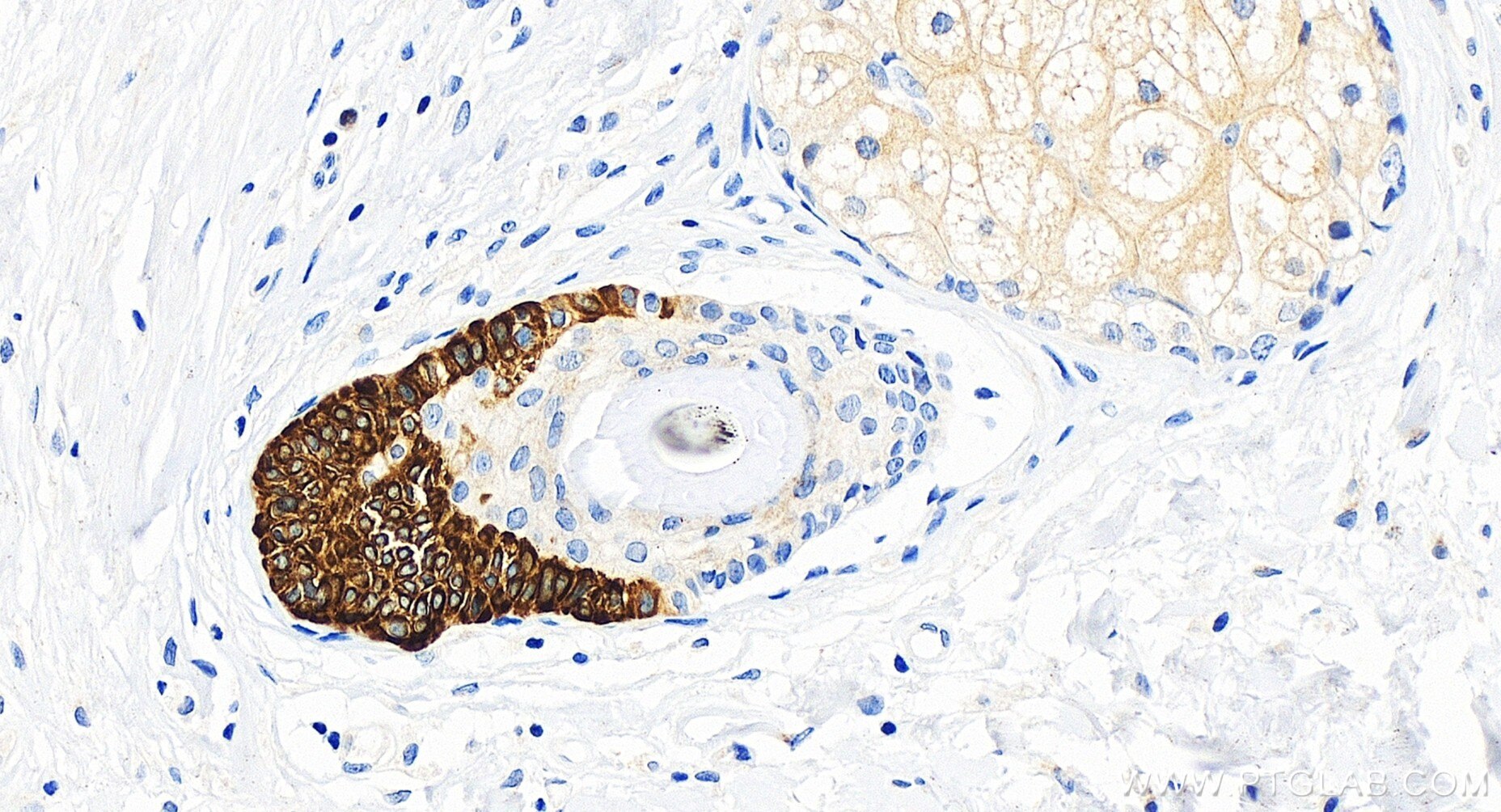 Immunohistochemistry (IHC) staining of human skin tissue using Cytokeratin 19 Recombinant antibody (86250-1-RR)
