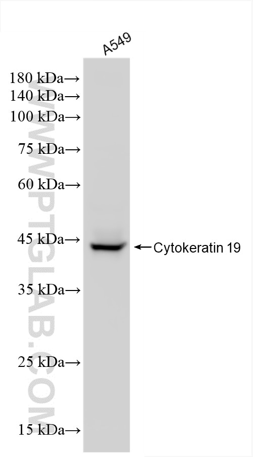 Western Blot (WB) analysis of A549 cells using Cytokeratin 19 Recombinant antibody (86250-1-RR)