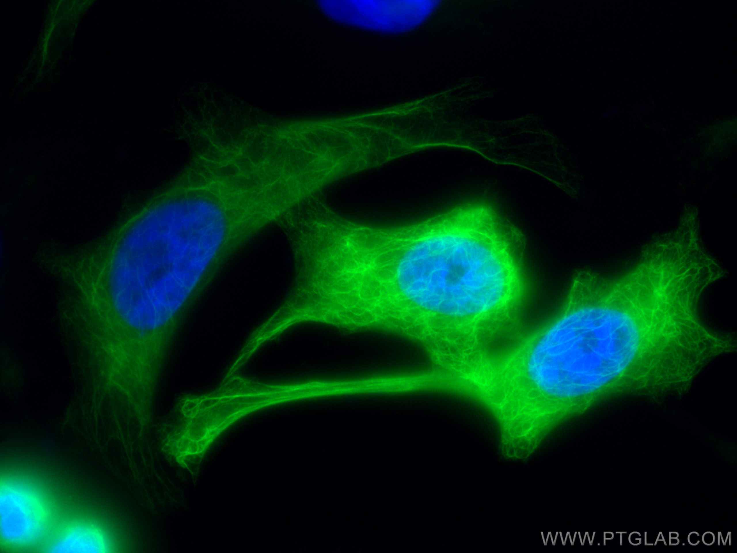 Cytokeratin 19