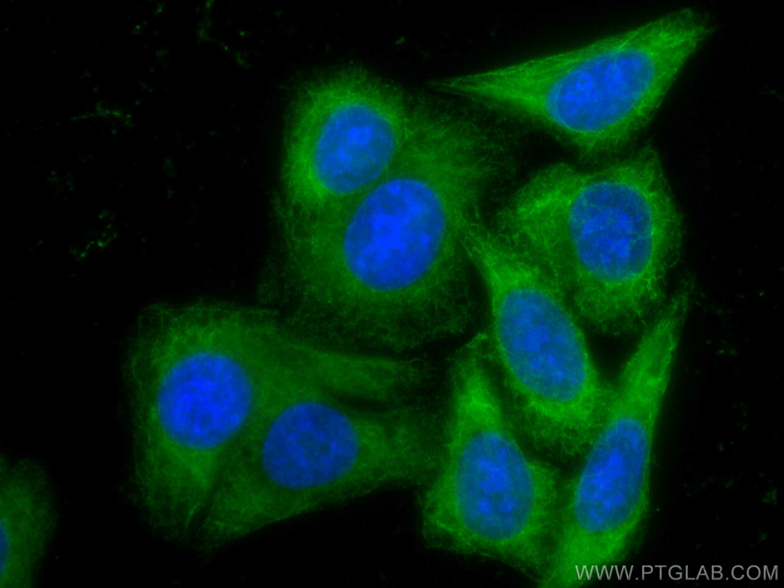 Immunofluorescence (IF) / fluorescent staining of HepG2 cells using CoraLite® Plus 488-conjugated Cytokeratin 19 Polyc (CL488-10712)