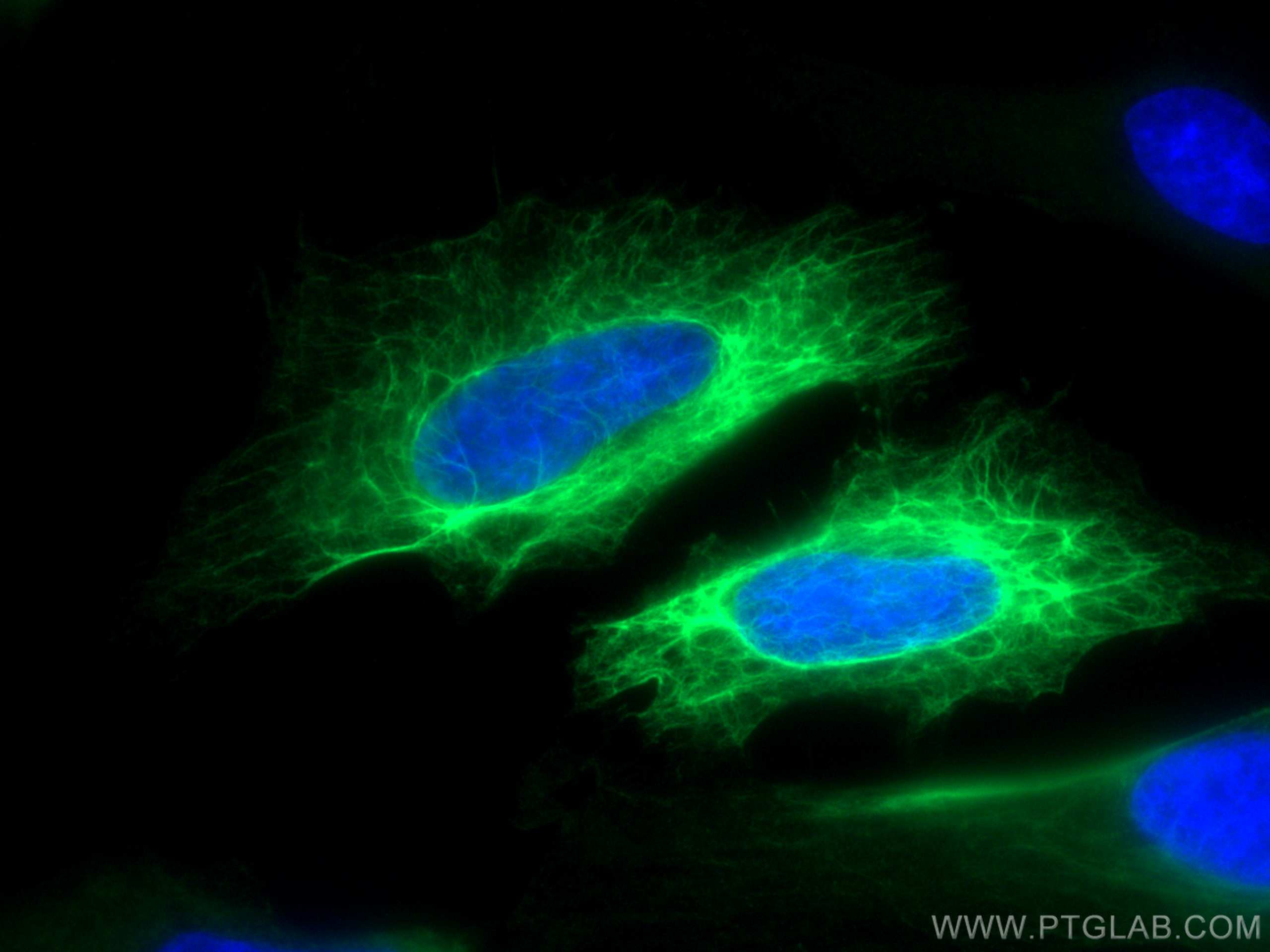 Immunofluorescence (IF) / fluorescent staining of HeLa cells using CoraLite® Plus 488-conjugated Cytokeratin 19 Polyc (CL488-10712)