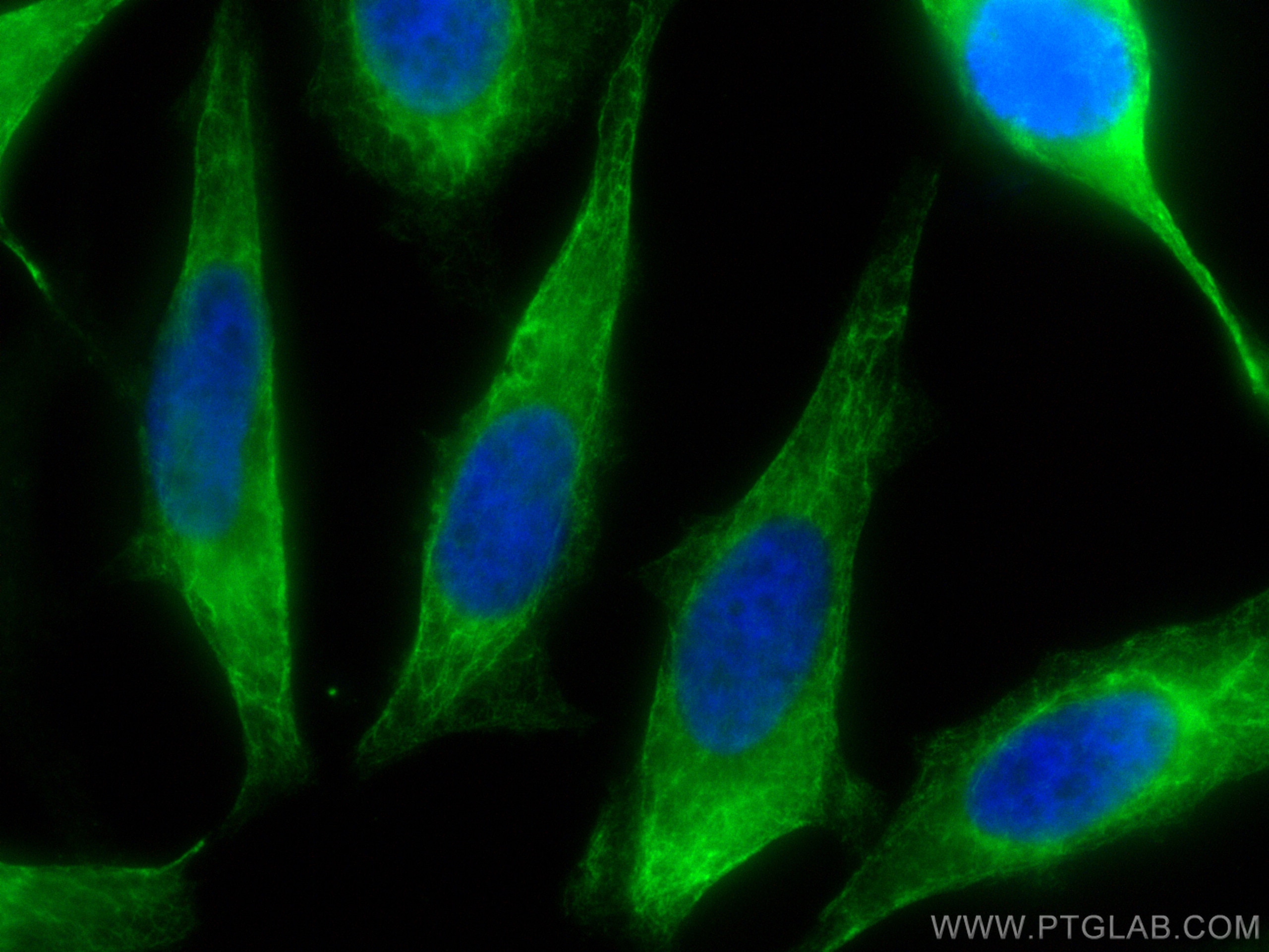 Immunofluorescence (IF) / fluorescent staining of HeLa cells using CoraLite® Plus 488-conjugated Cytokeratin 19 Polyc (CL488-10712)