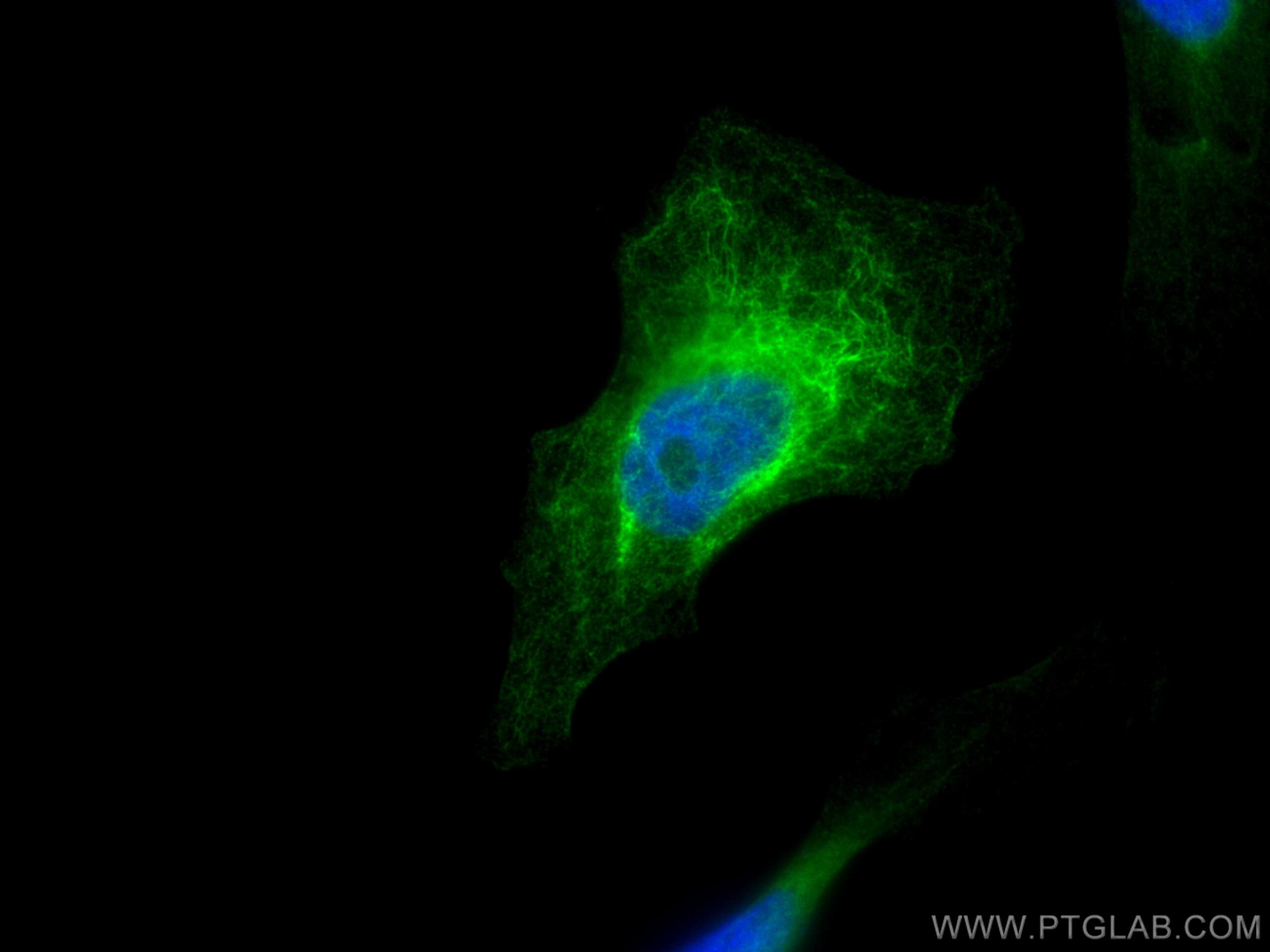 Immunofluorescence (IF) / fluorescent staining of HeLa cells using CoraLite® Plus 488-conjugated Cytokeratin 19 Polyc (CL488-14965)