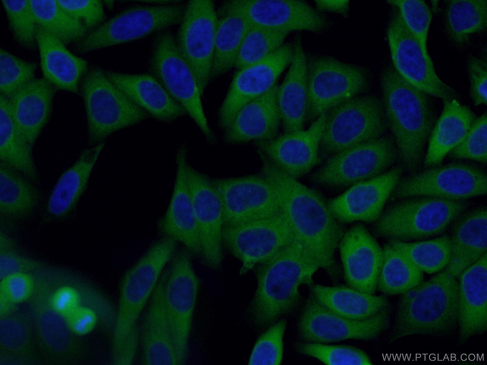 Immunofluorescence (IF) / fluorescent staining of HepG2 cells using CoraLite® Plus 488-conjugated Cytokeratin 19 Monoc (CL488-60187)
