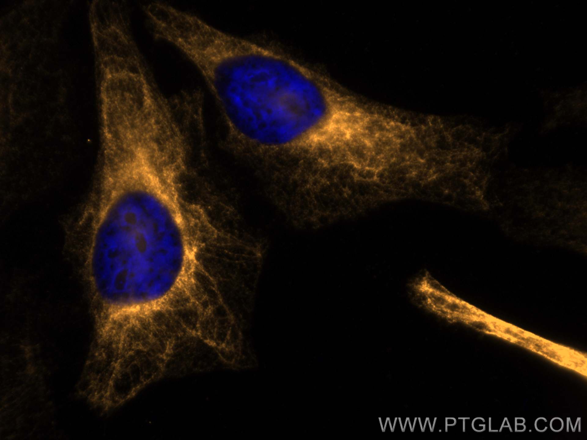 Immunofluorescence (IF) / fluorescent staining of HeLa cells using CoraLite® Plus 555-conjugated Cytokeratin 19 Polyc (CL555-10712)