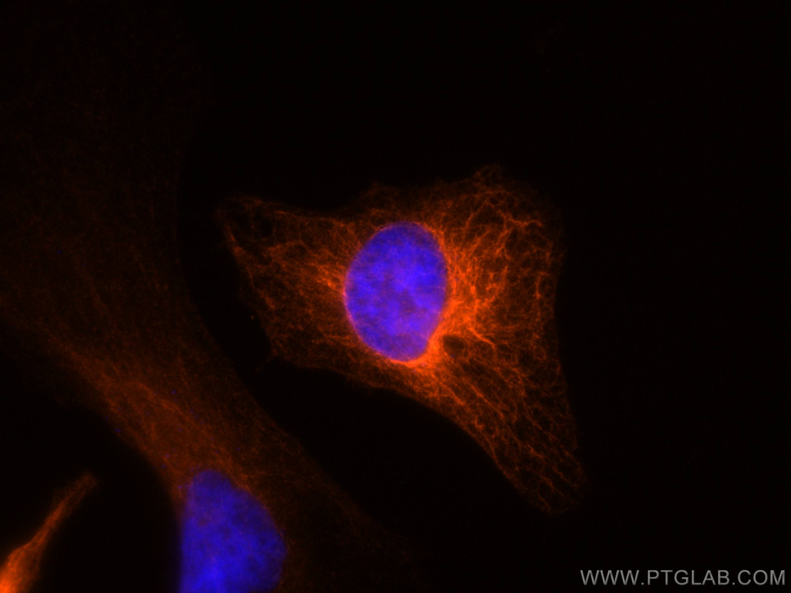 Cytokeratin 19