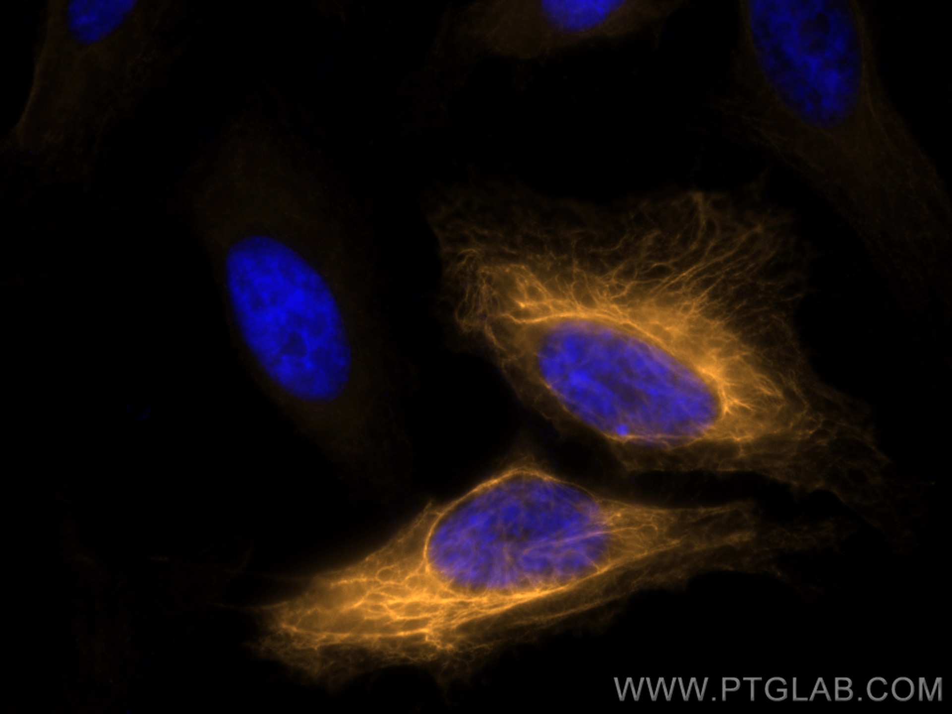 Immunofluorescence (IF) / fluorescent staining of HeLa cells using CoraLite®555-conjugated Cytokeratin 19 Polyclonal  (CL555-14965)