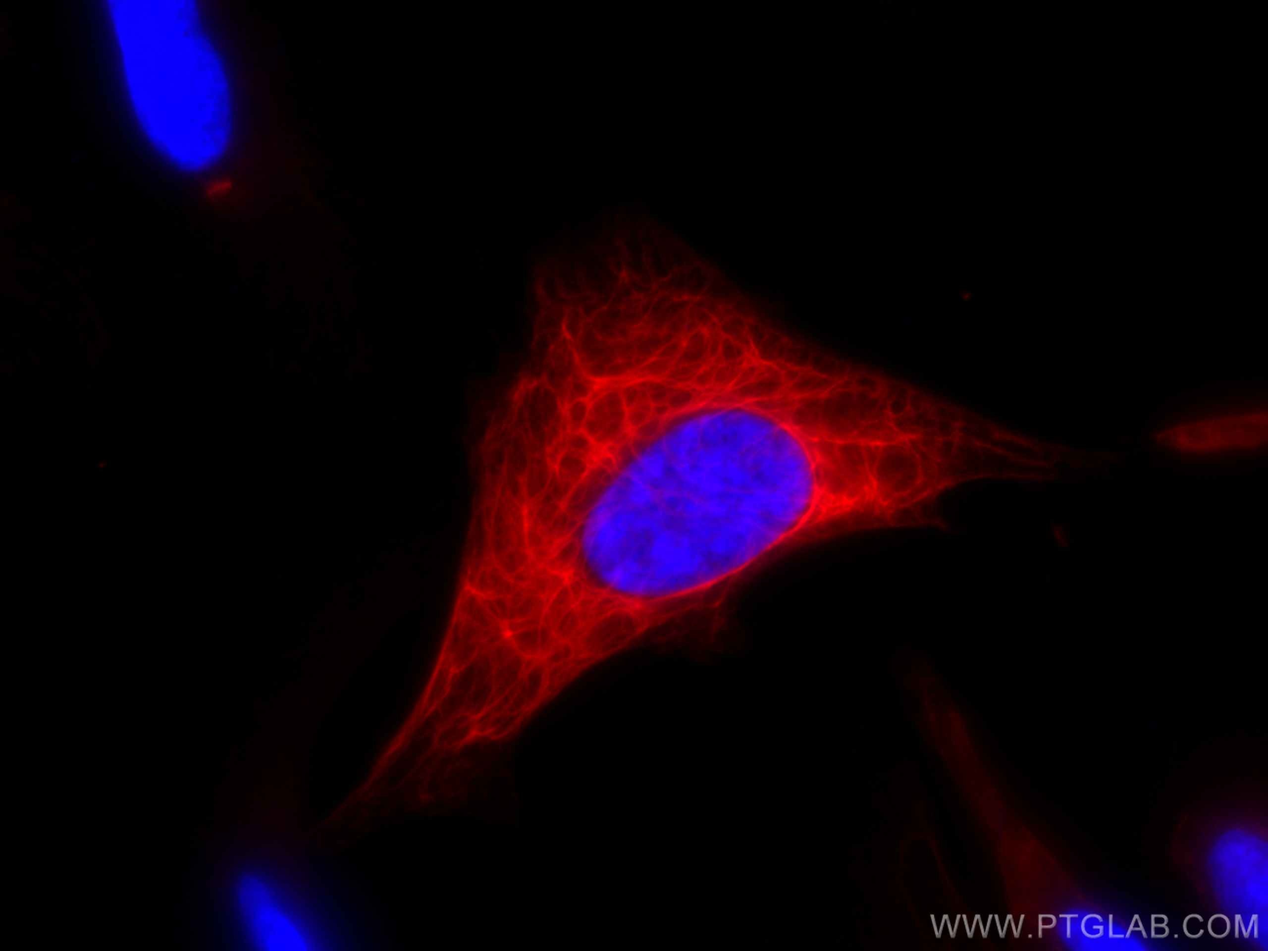 Immunofluorescence (IF) / fluorescent staining of HeLa cells using CoraLite®594-conjugated Cytokeratin 19 Polyclonal  (CL594-10712)