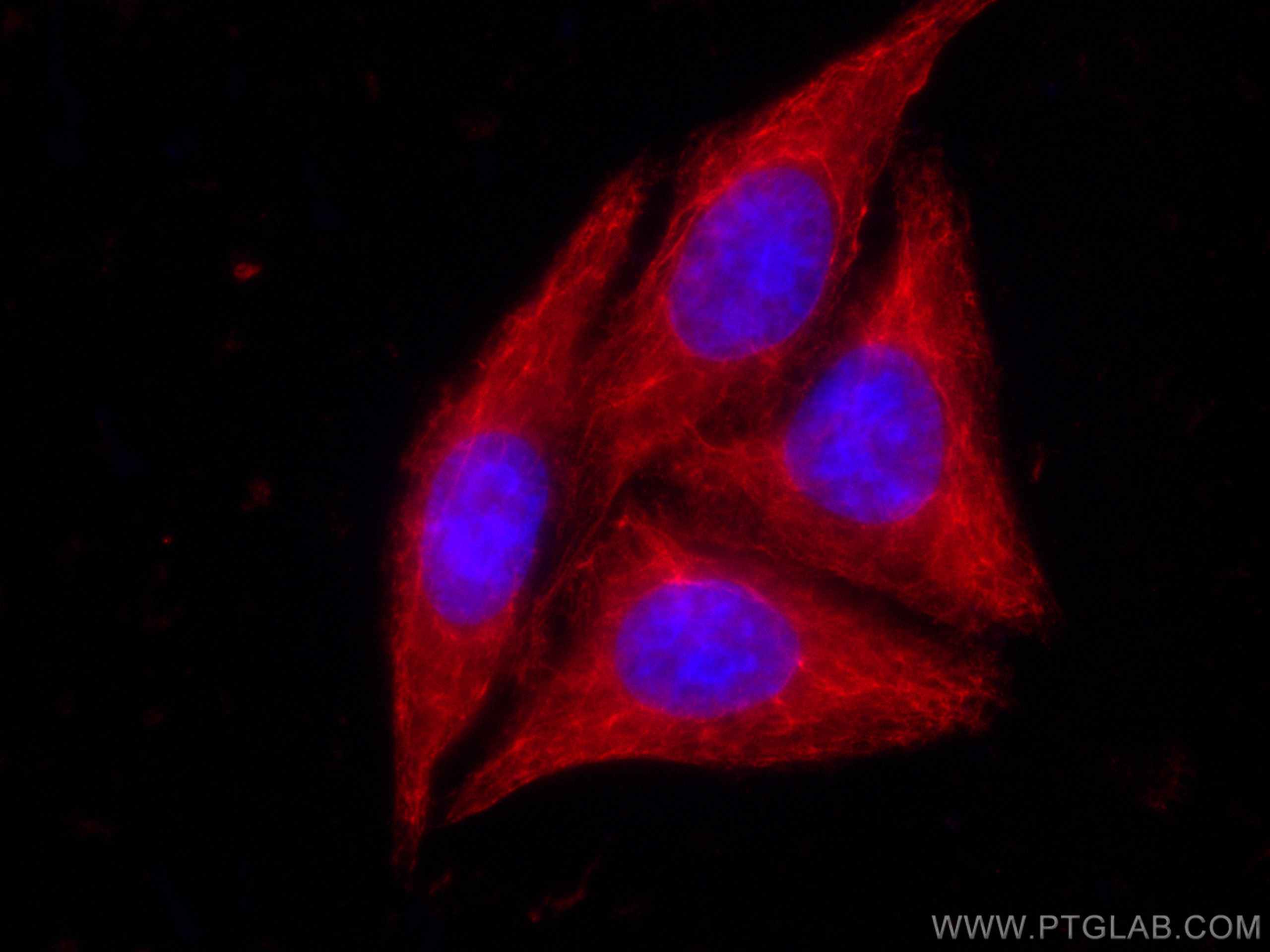 Immunofluorescence (IF) / fluorescent staining of HepG2 cells using CoraLite®594-conjugated Cytokeratin 19 Polyclonal  (CL594-10712)
